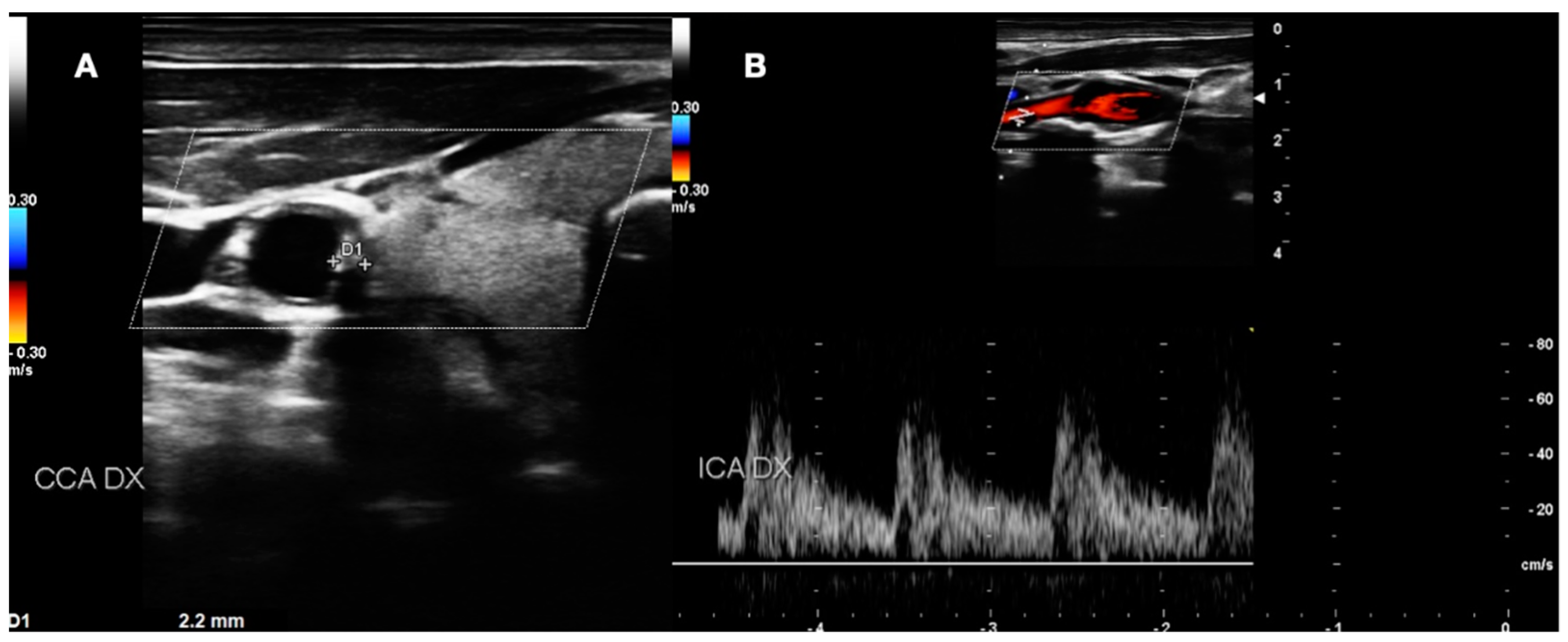 Diagnostics 13 00644 g006 Diagnostics 13 00644 g006