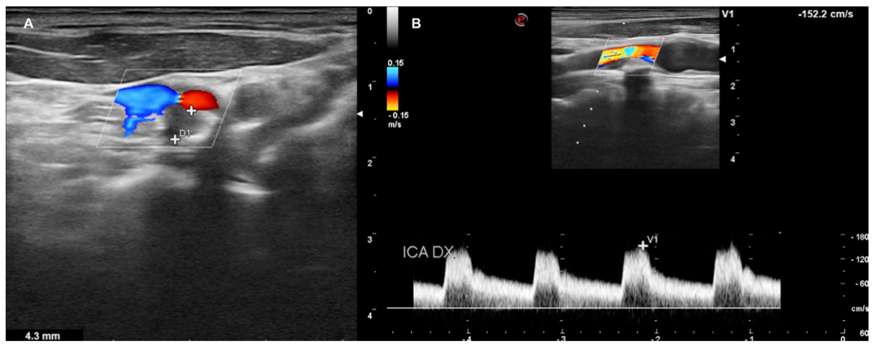 Diagnostics 13 00644 g007 Diagnostics 13 00644 g007