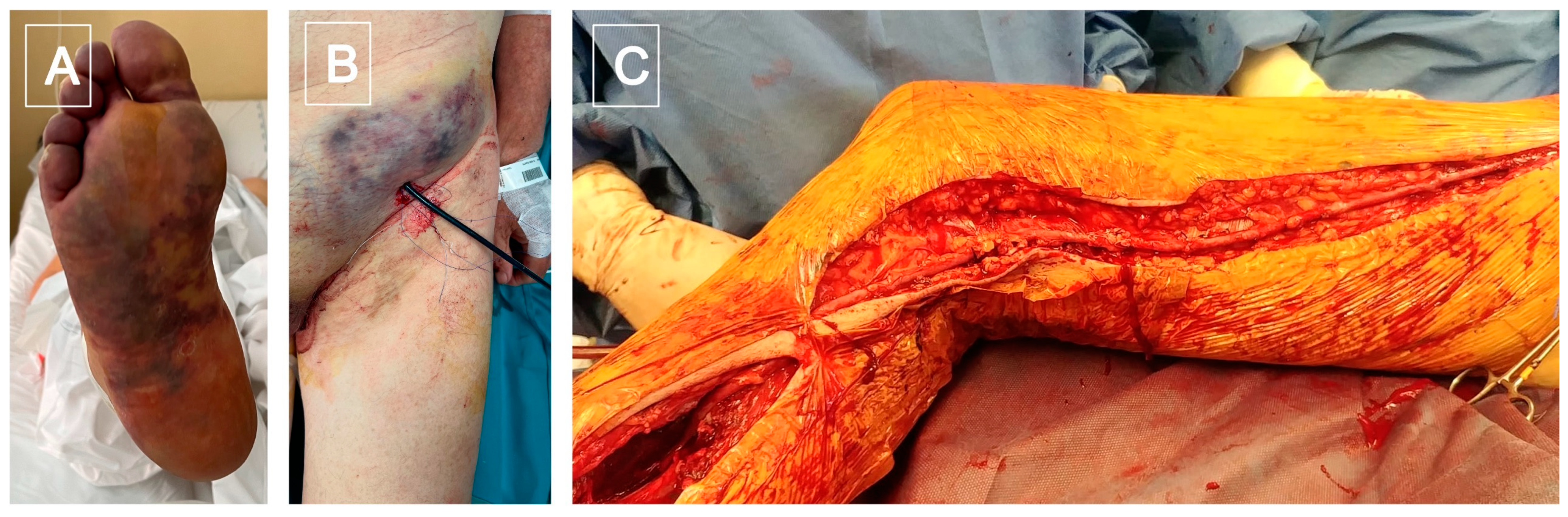 Diagnostics 13 00647 g003