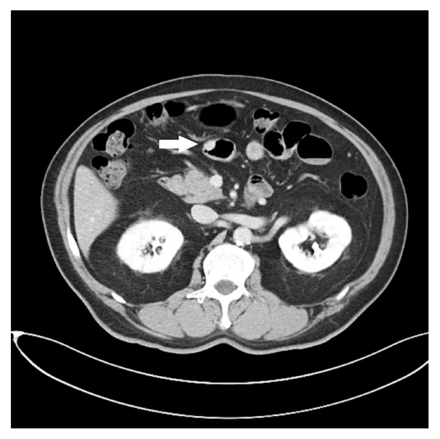 Diagnostics 13 00660 g001