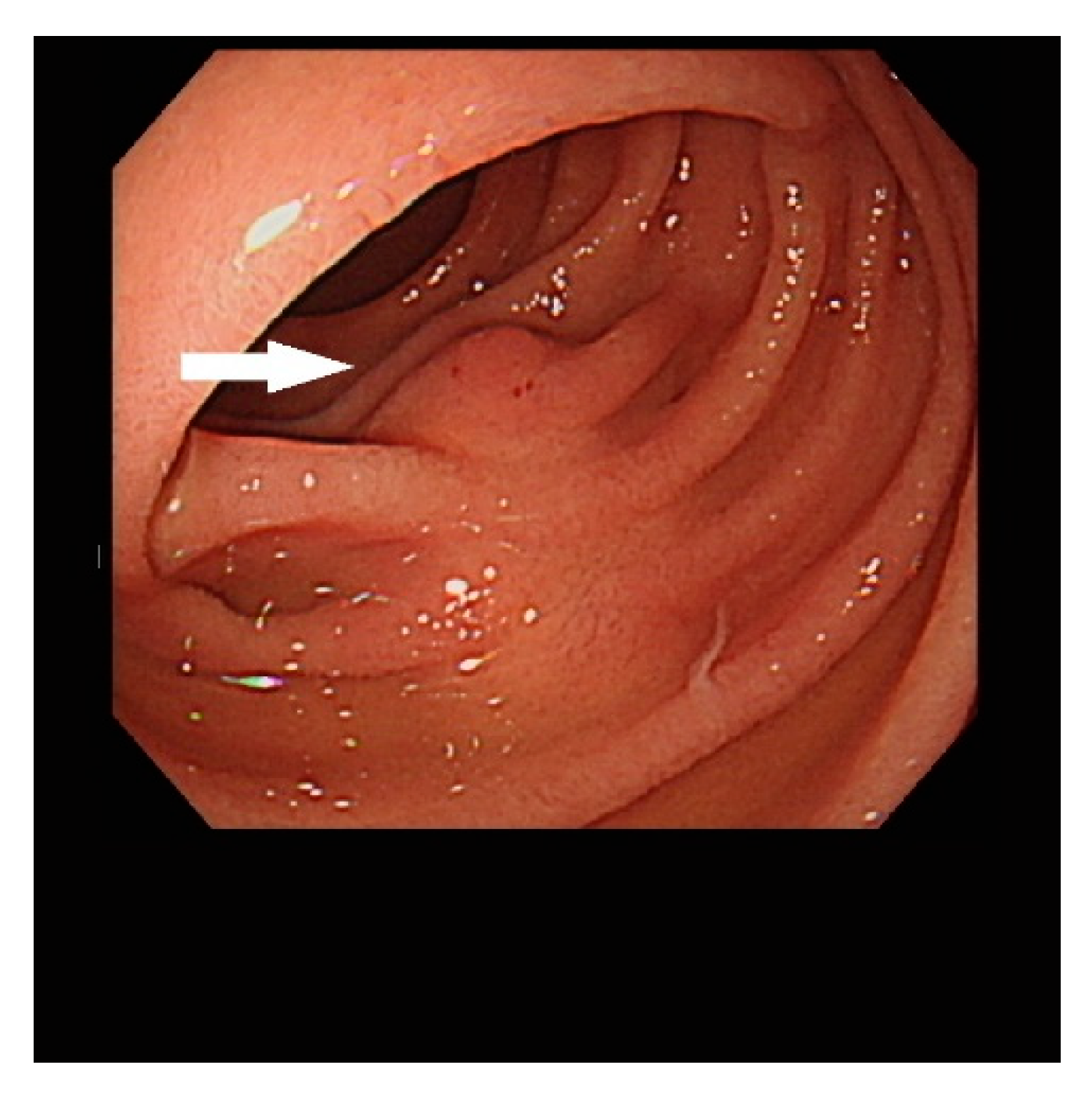 Diagnostics 13 00660 g002