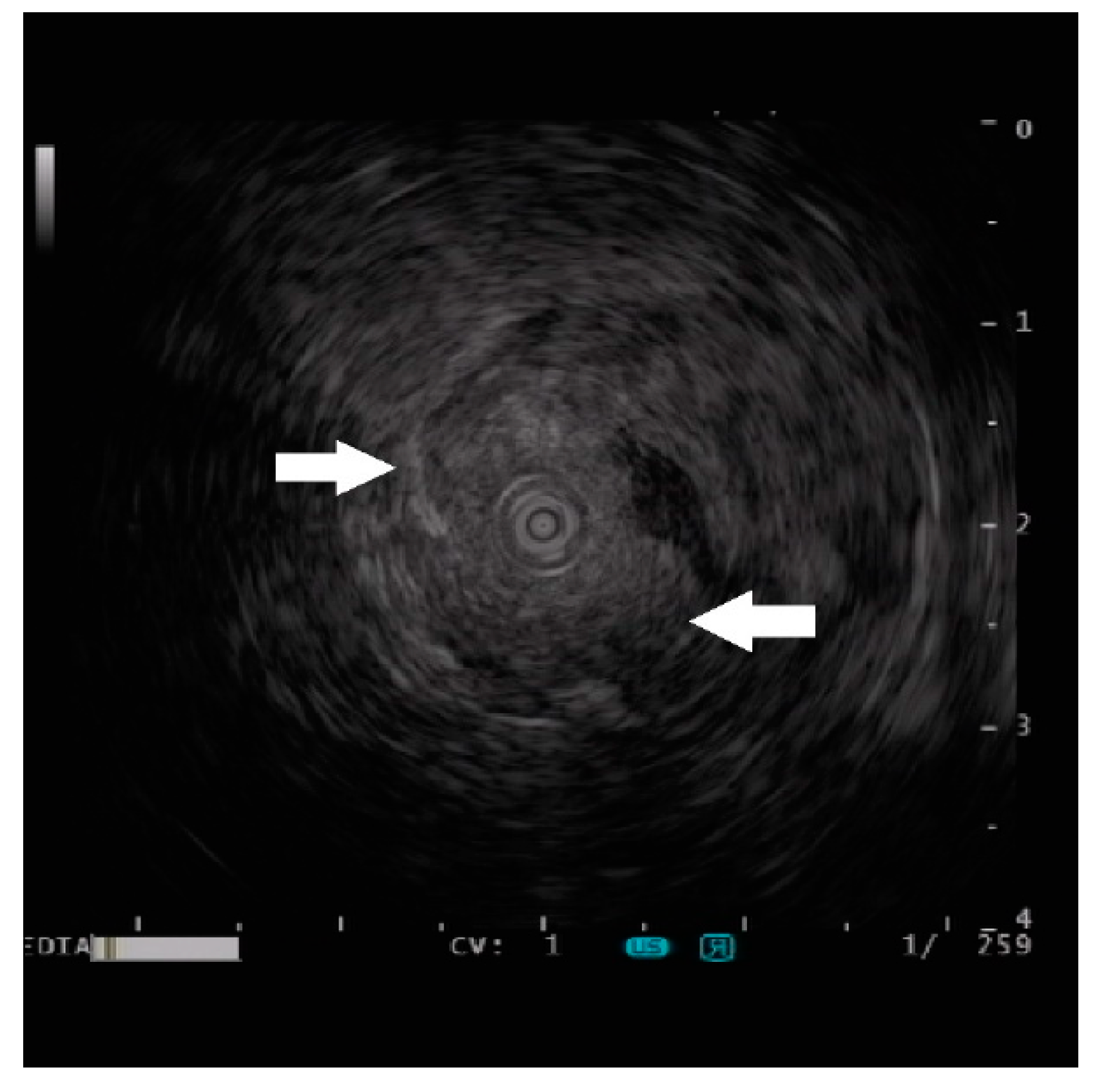 Diagnostics 13 00660 g003