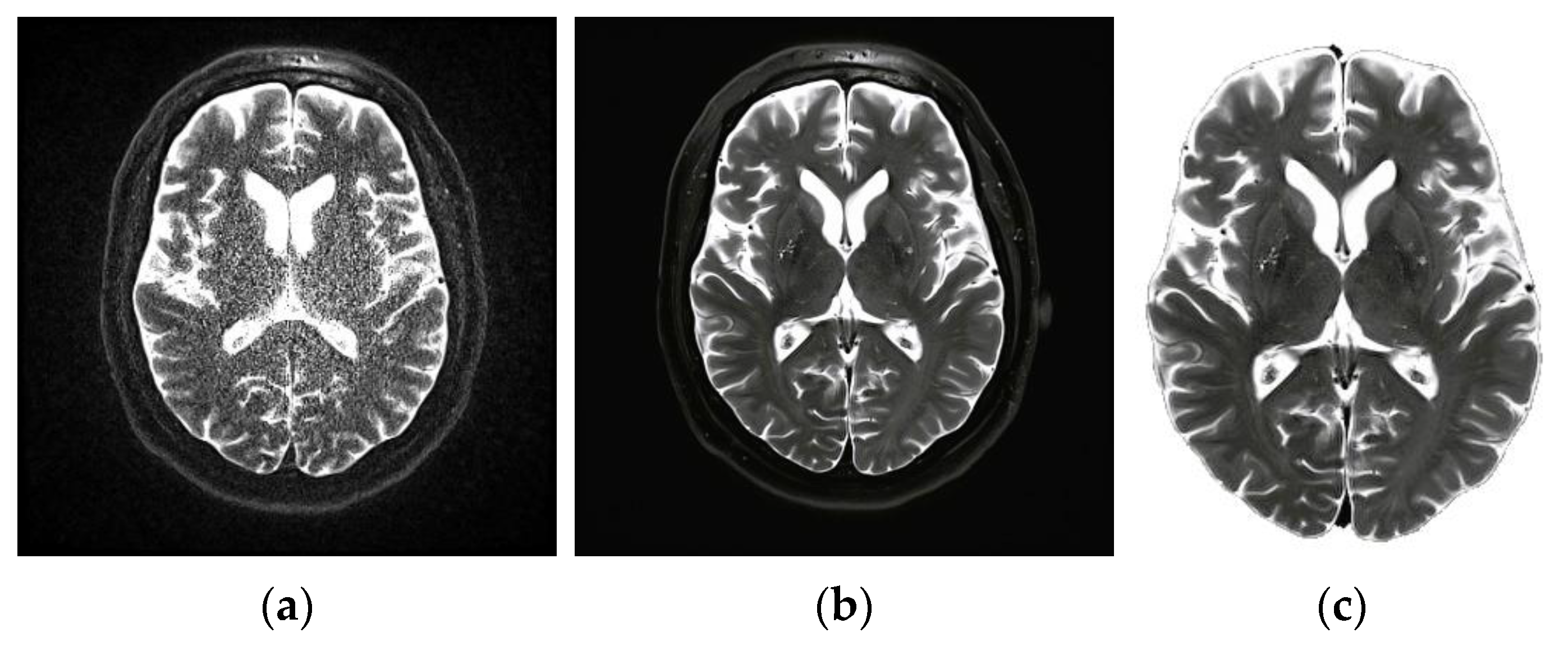 Diagnostics 13 00668 g002