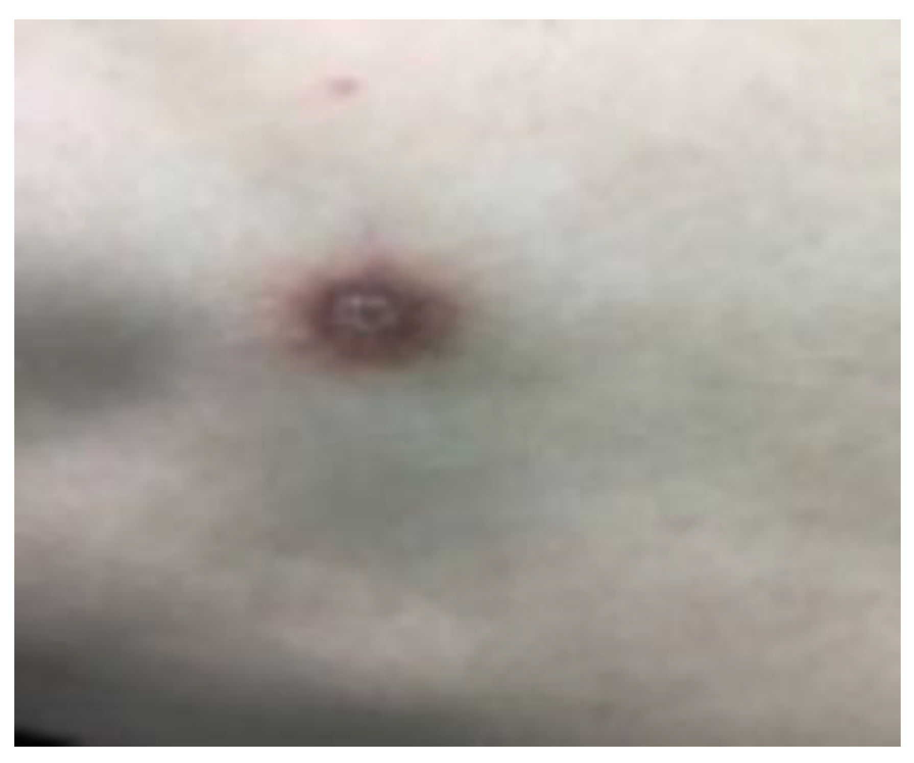 Diagnostics 13 00671 g002