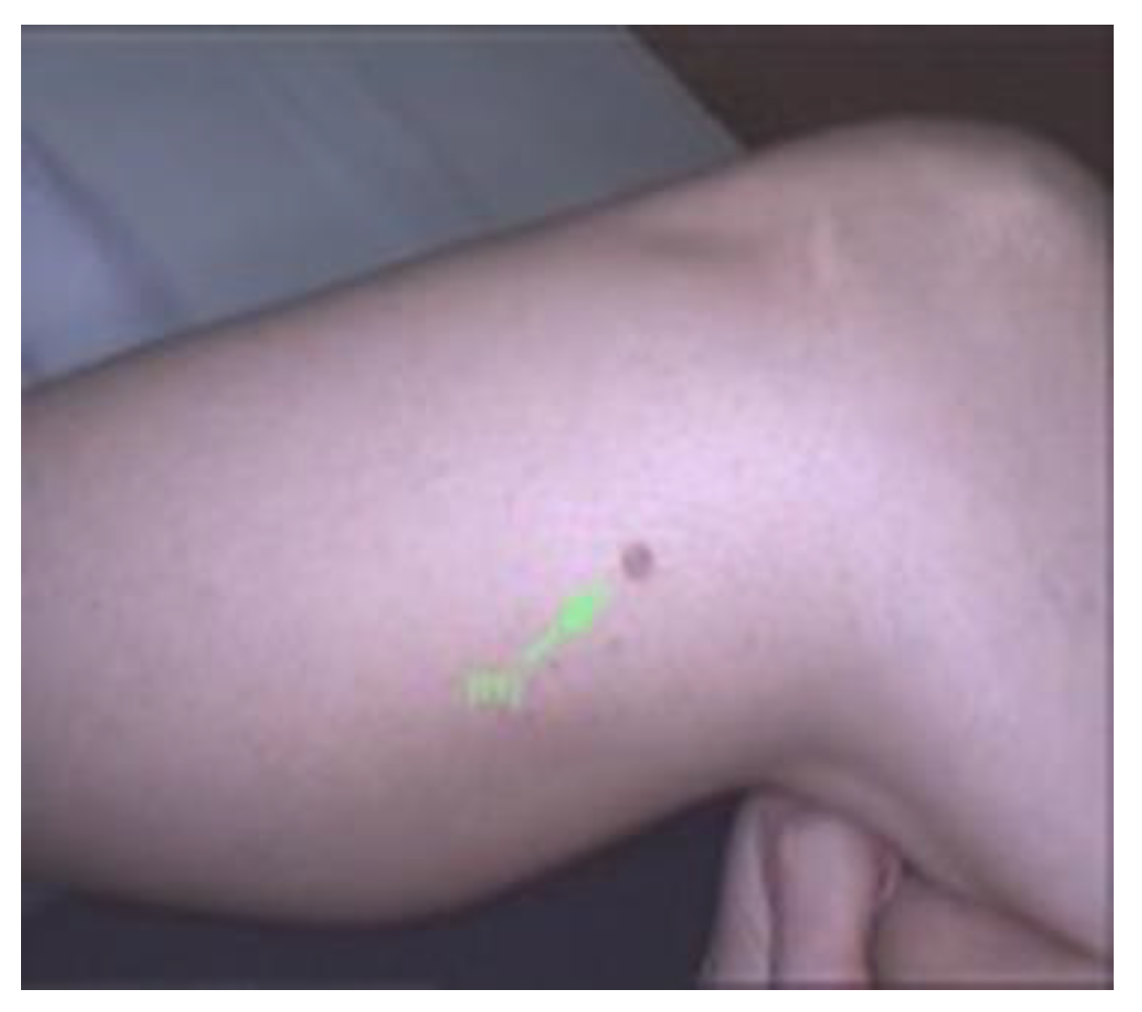 Diagnostics 13 00671 g003