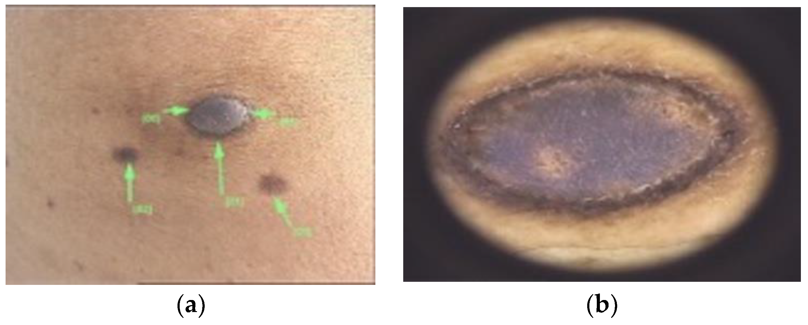 Diagnostics 13 00671 g004