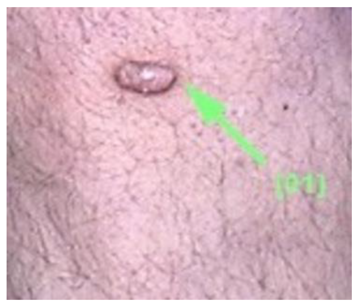 Diagnostics 13 00671 g005