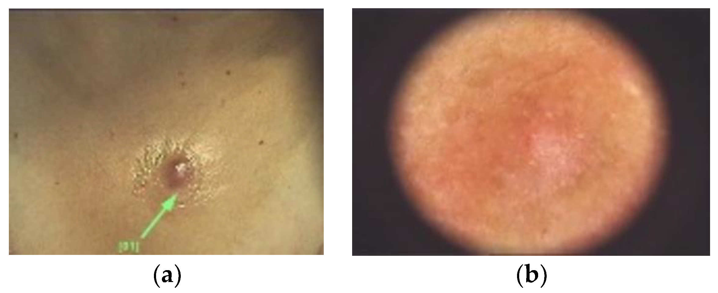 Diagnostics 13 00671 g011