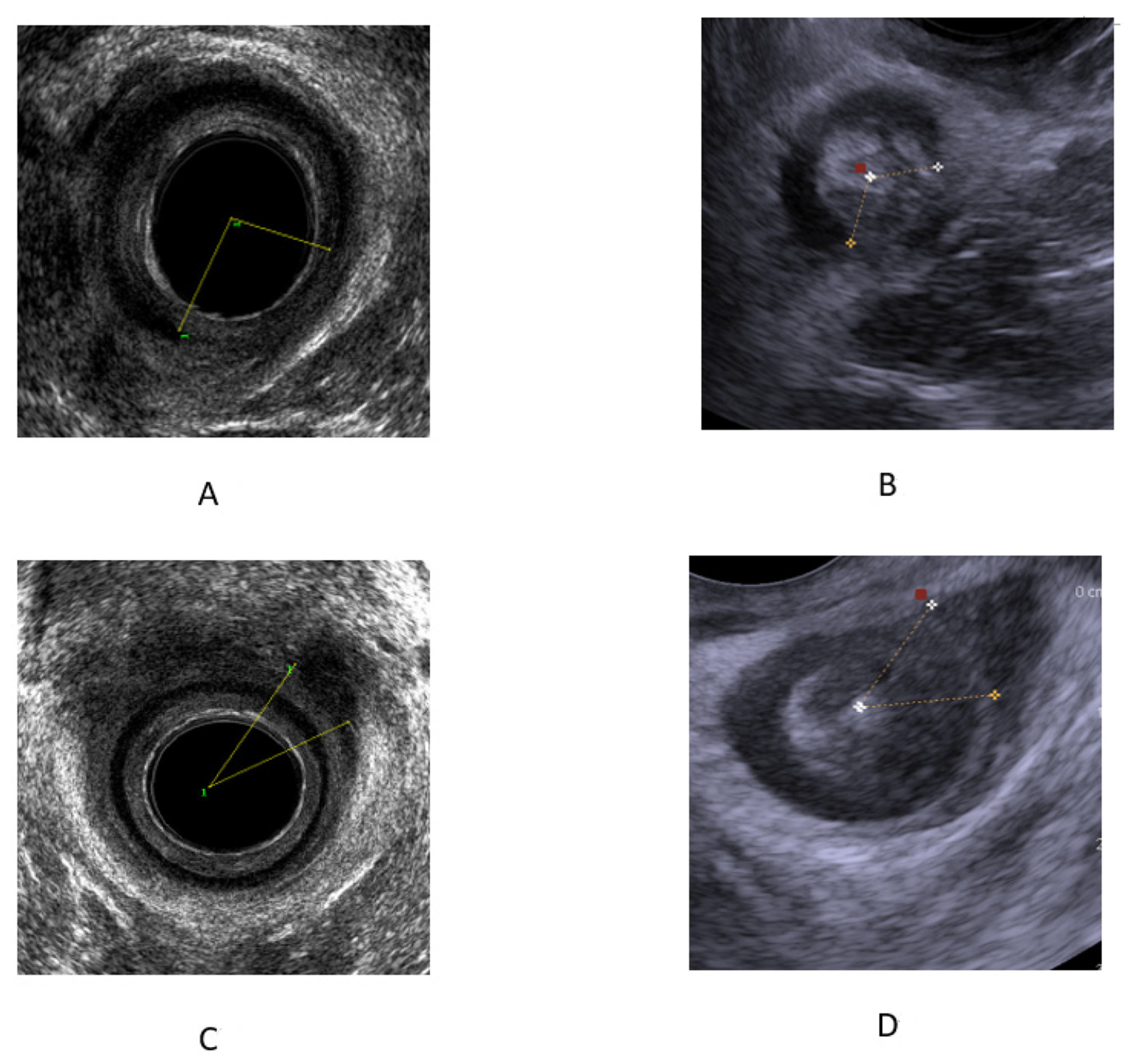 Diagnostics 13 00682 g002