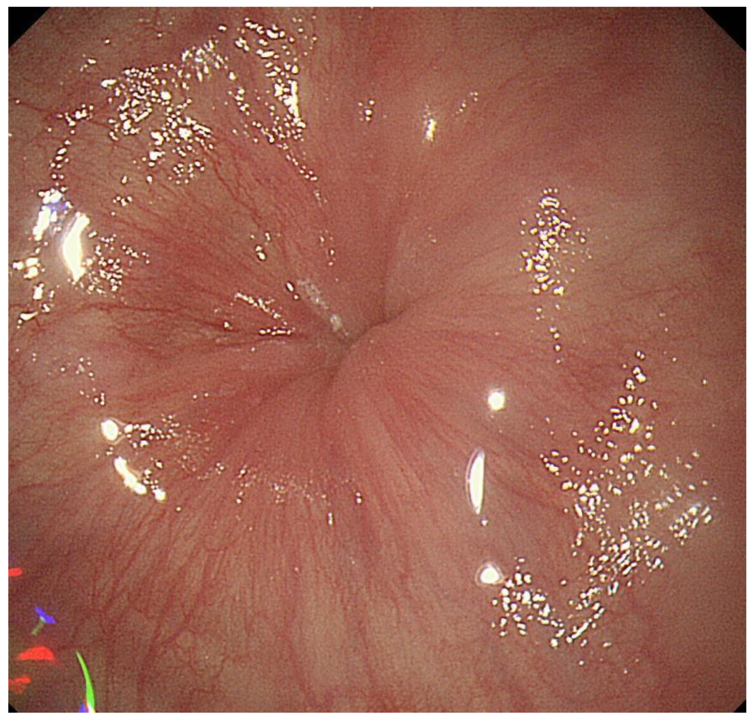 Diagnostics 13 00695 g003