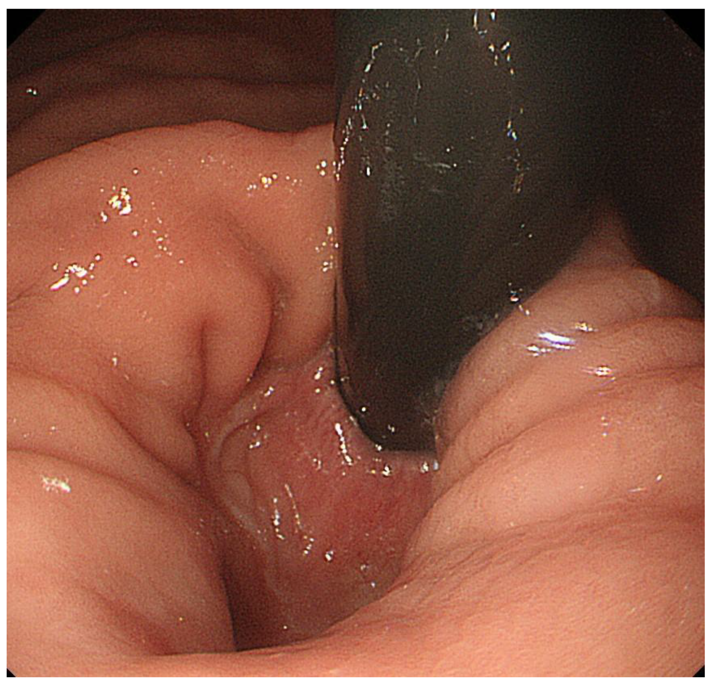 Diagnostics 13 00695 g004