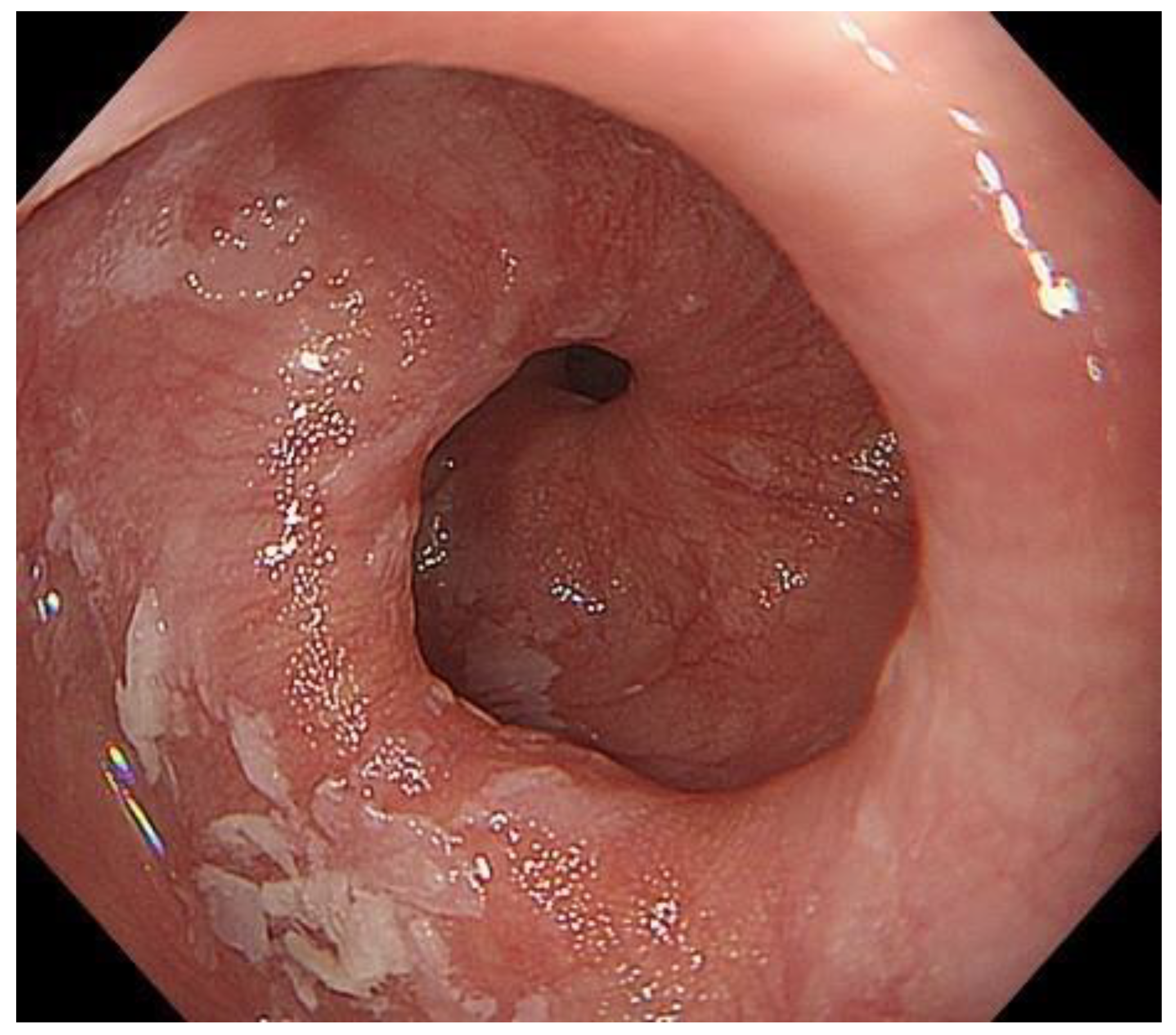 Diagnostics 13 00695 g006