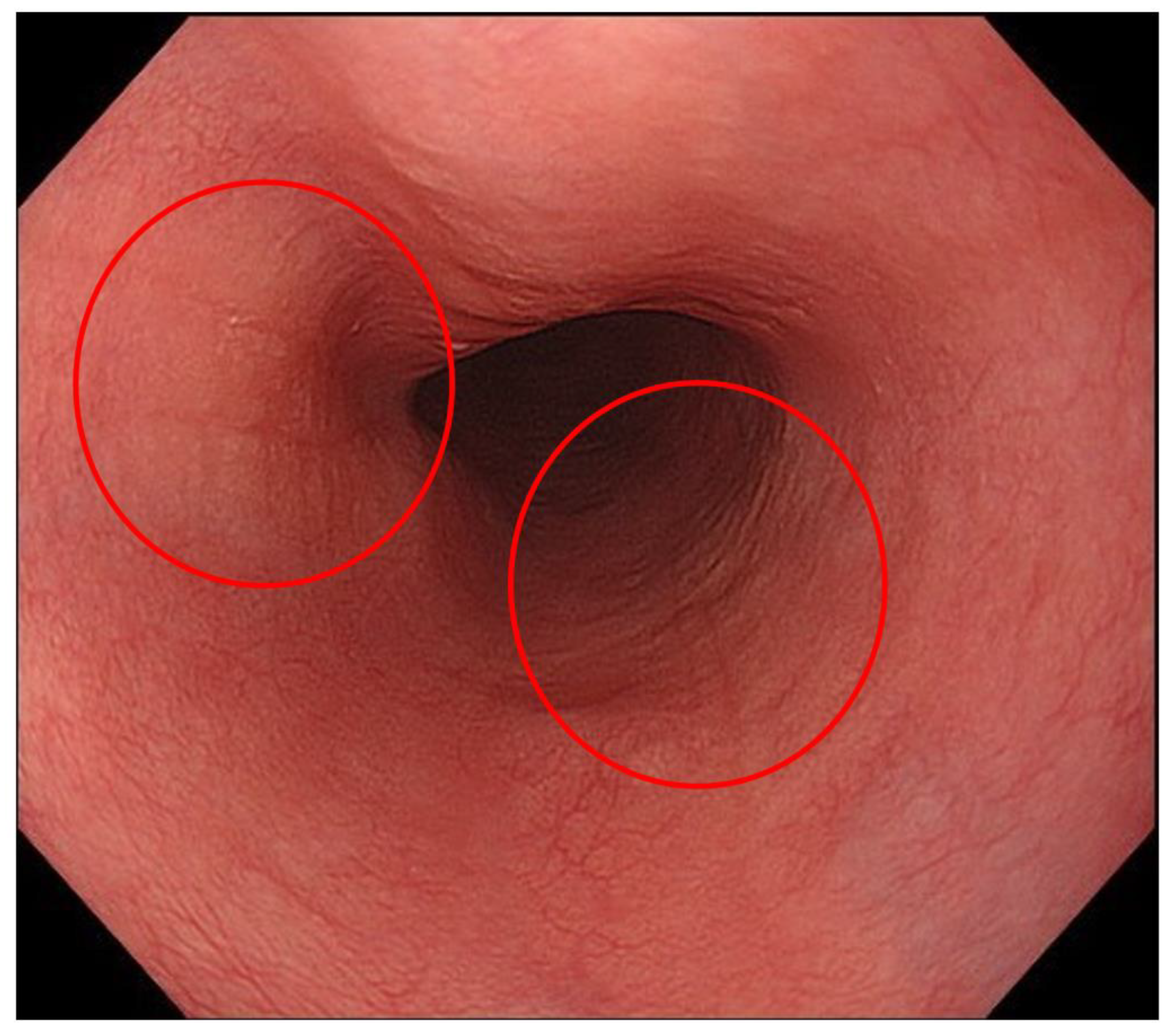 Diagnostics 13 00695 g007