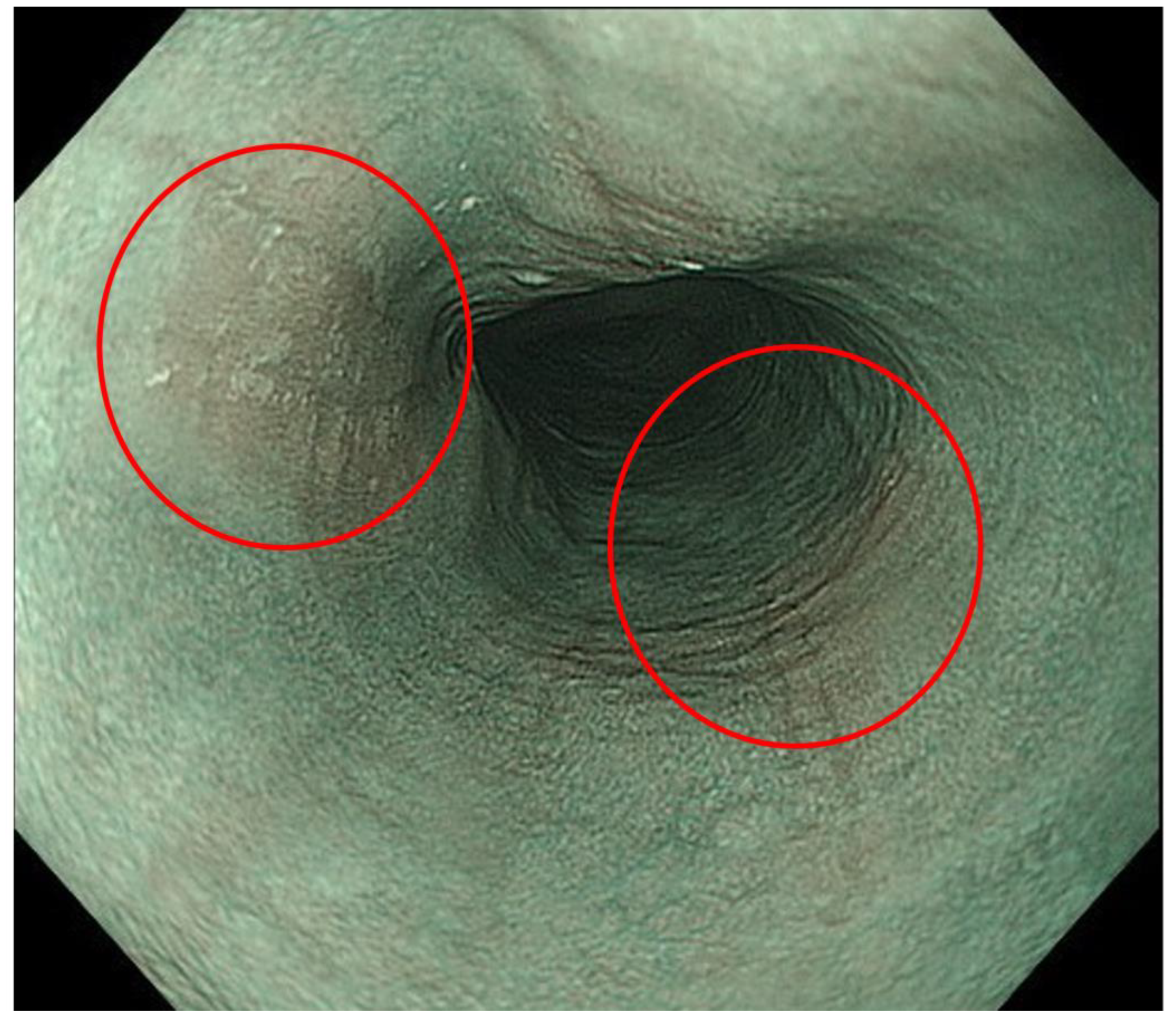 Diagnostics 13 00695 g008