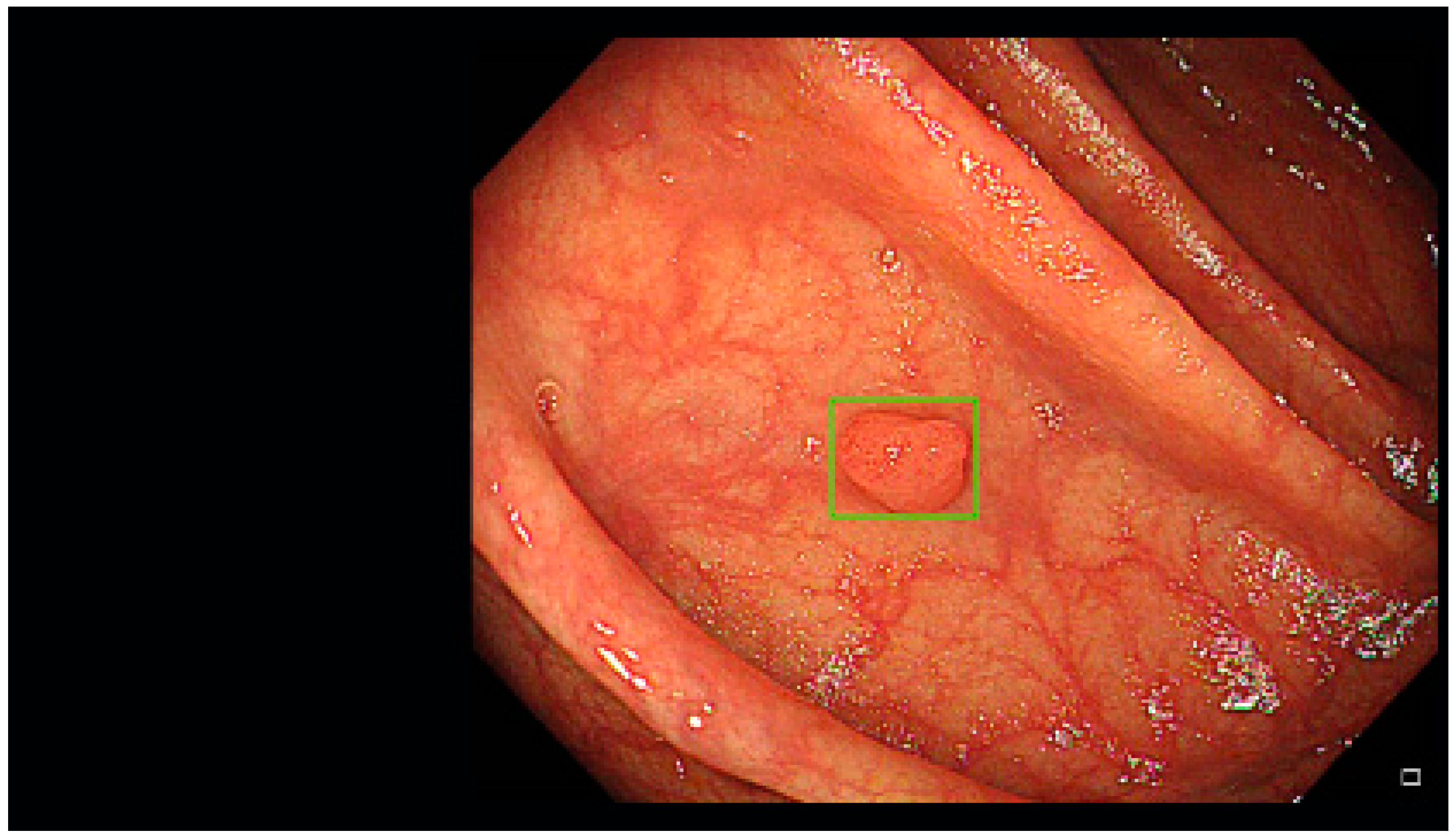 Diagnostics 13 00701 g001