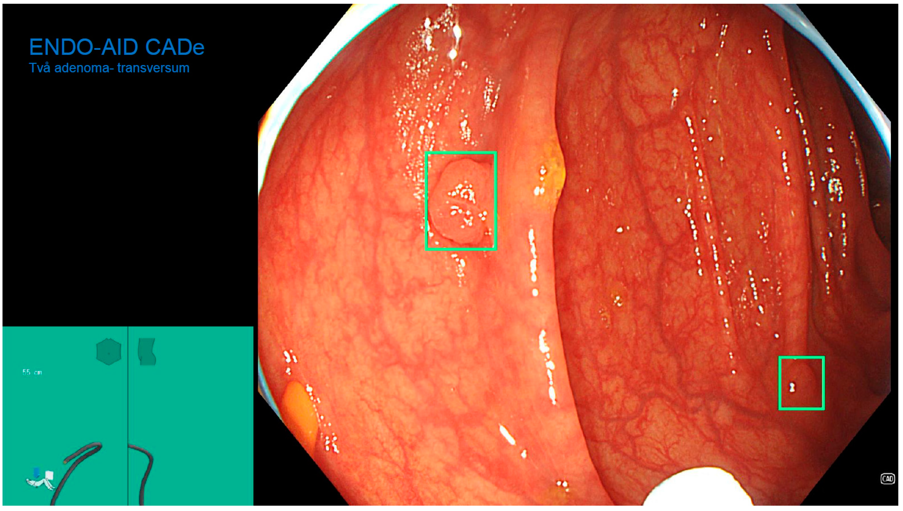 Diagnostics 13 00701 g002