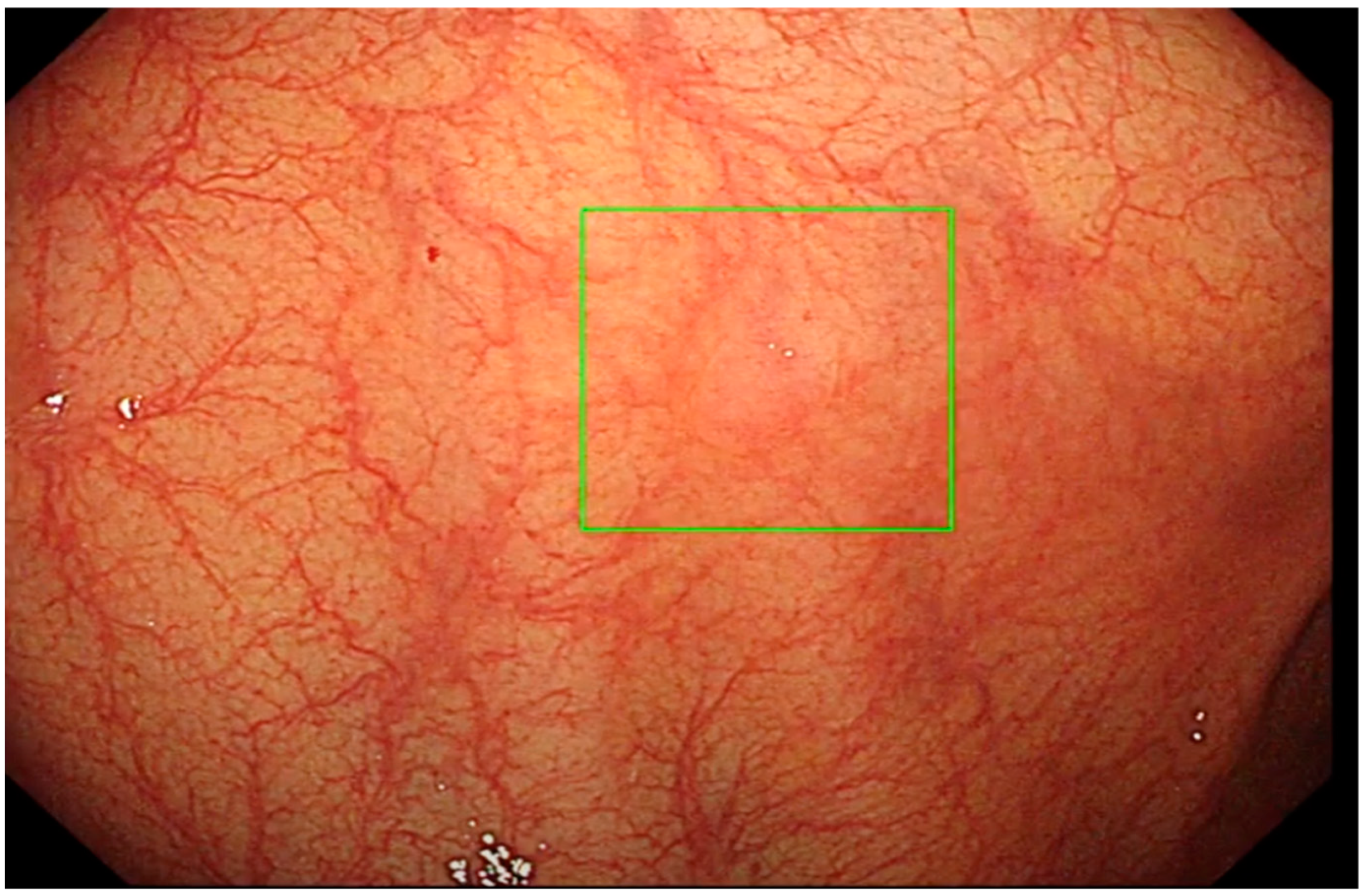 Diagnostics 13 00701 g005