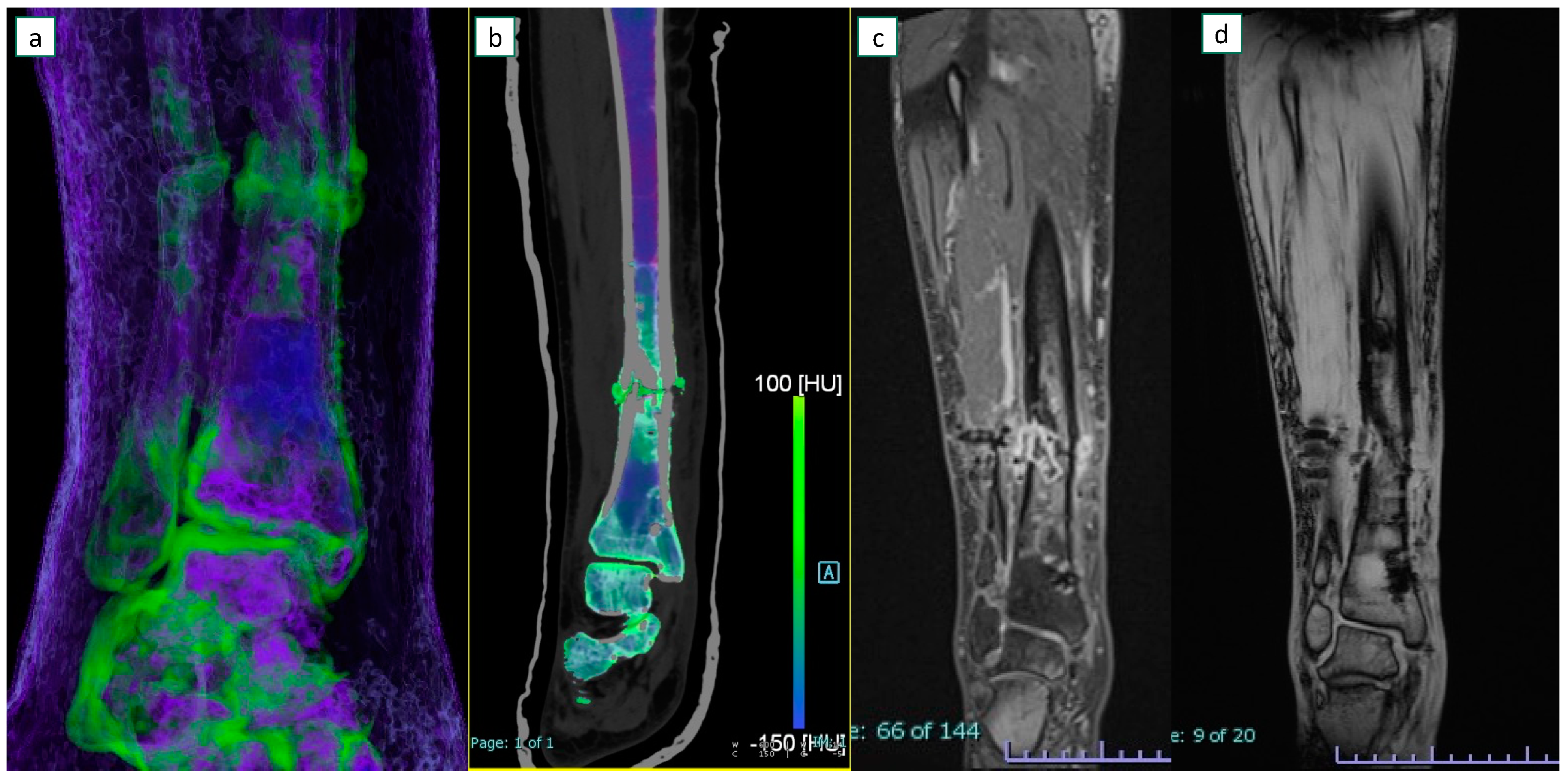 Diagnostics 13 00703 g004