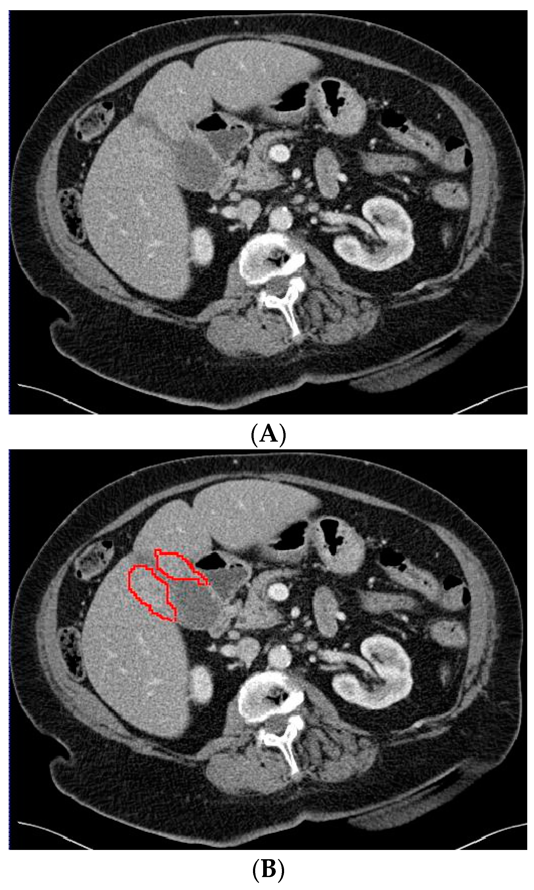 Diagnostics 13 00704 g002a