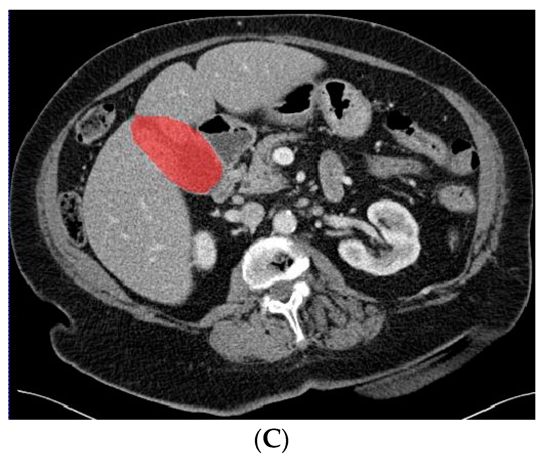 Diagnostics 13 00704 g002b