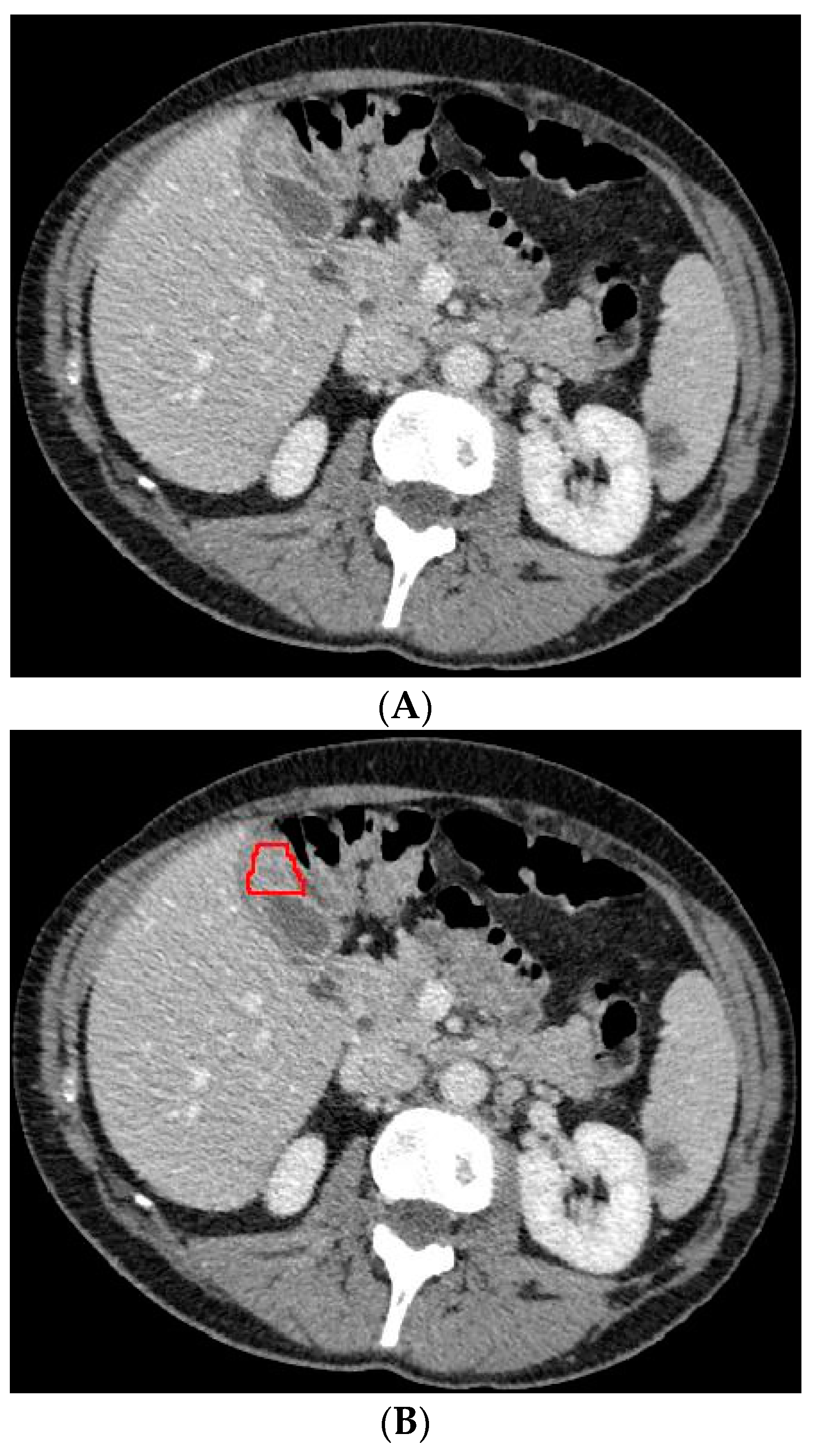 Diagnostics 13 00704 g003a