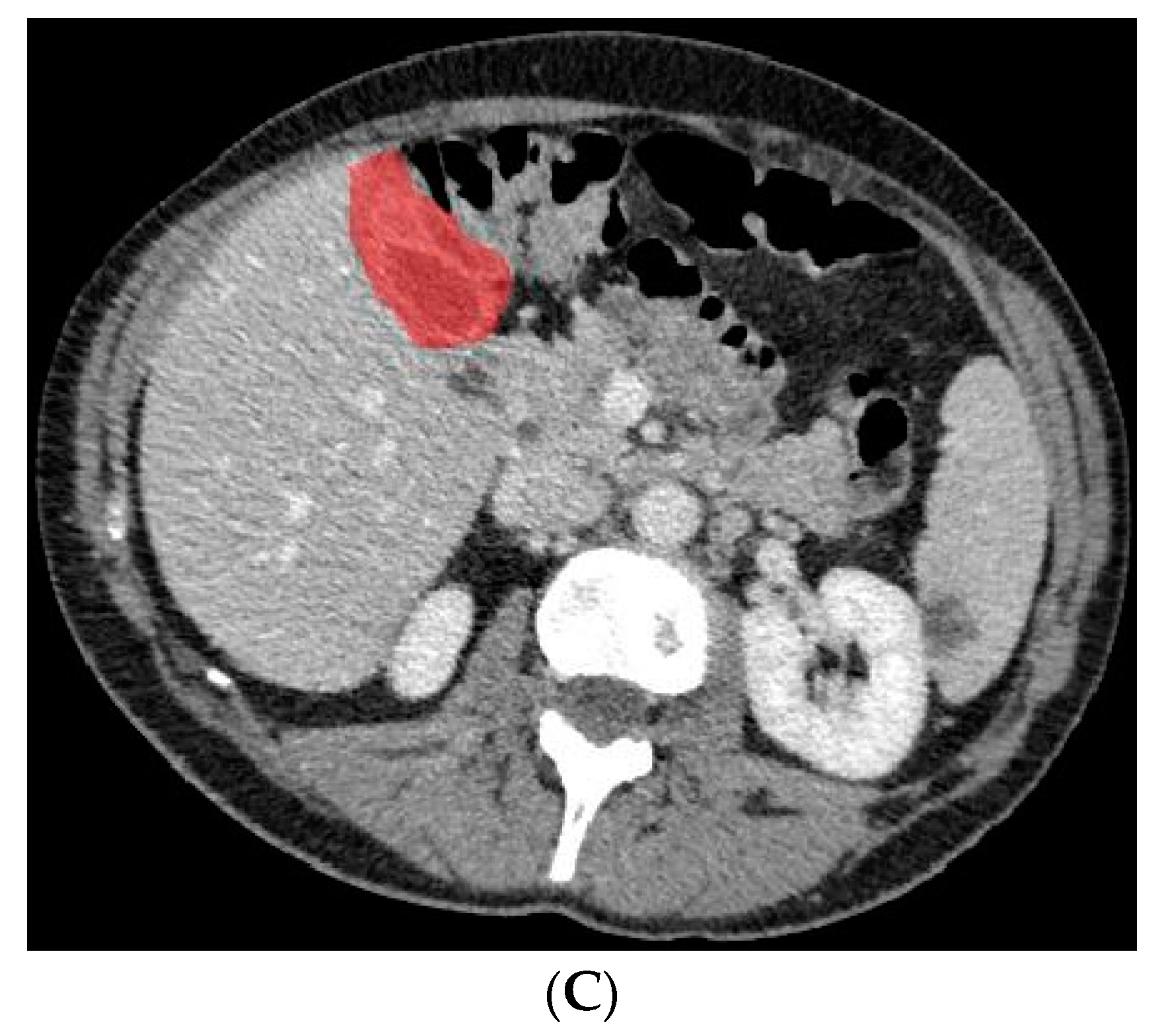 Diagnostics 13 00704 g003b
