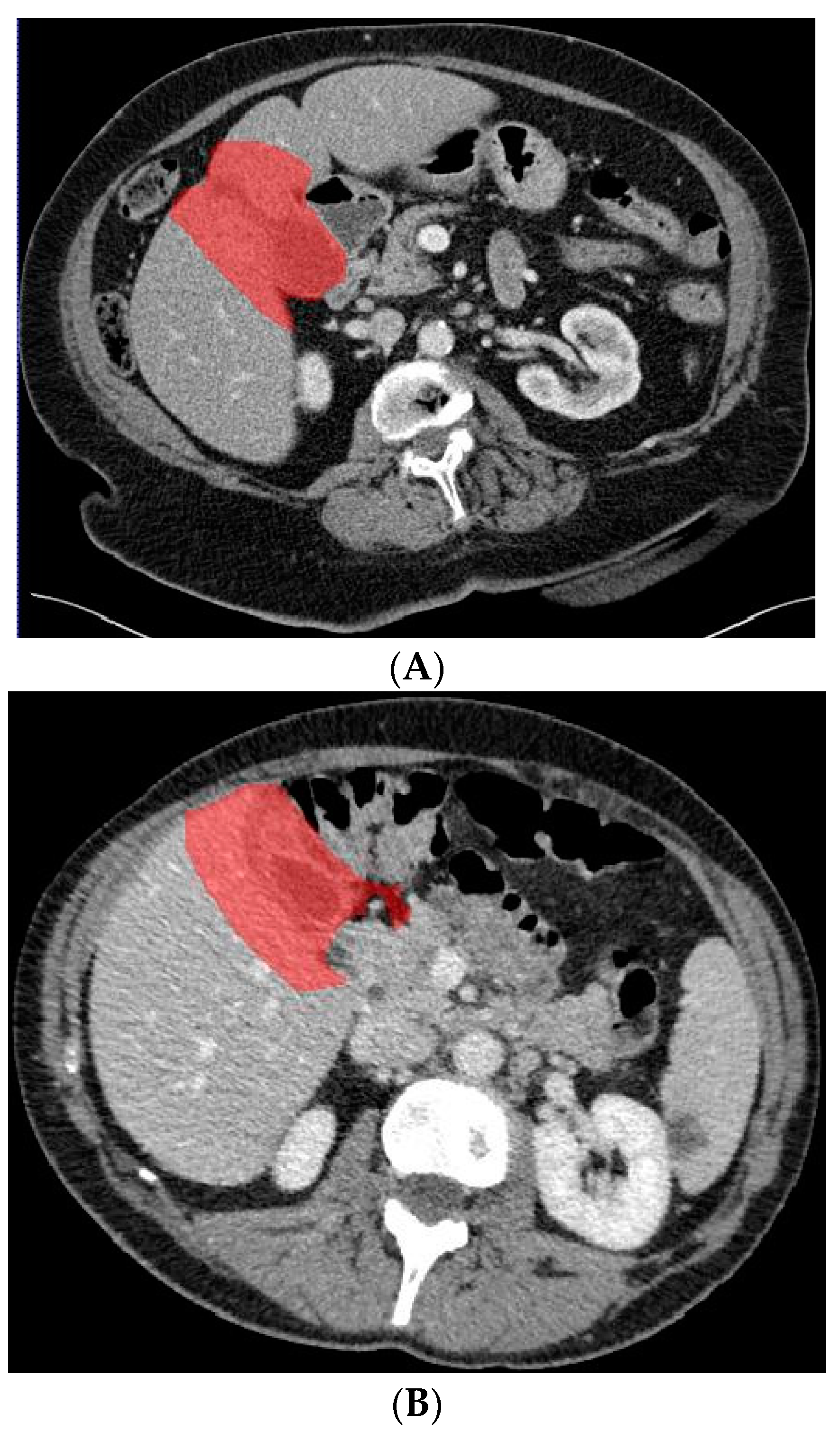 Diagnostics 13 00704 g004