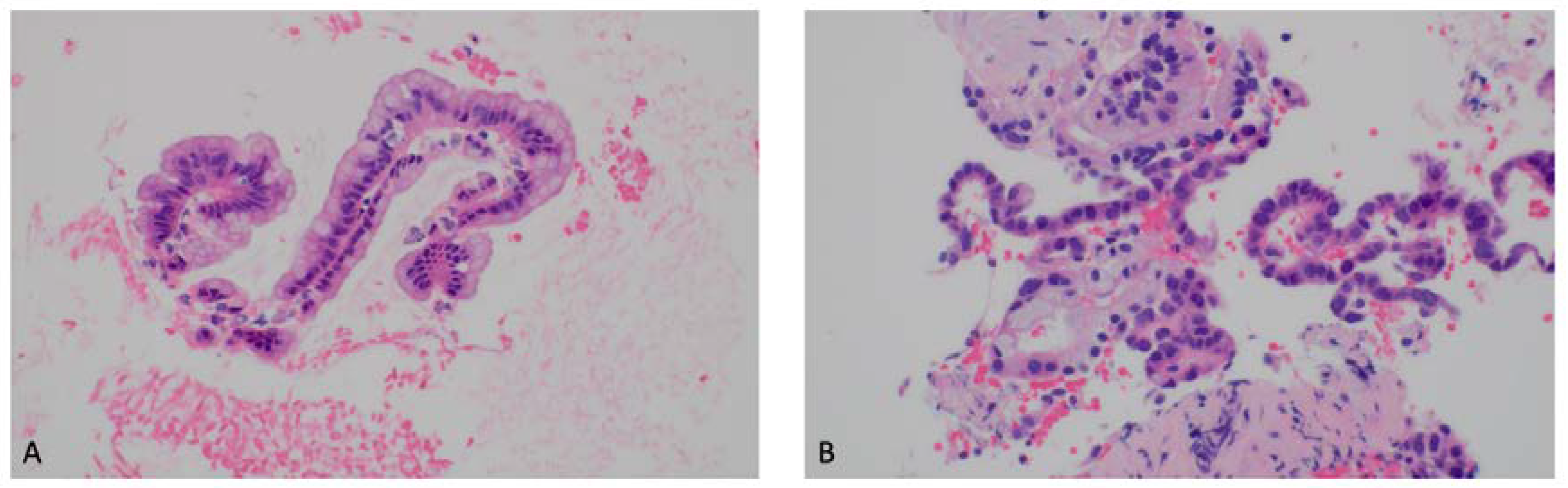 Diagnostics 13 00705 g004