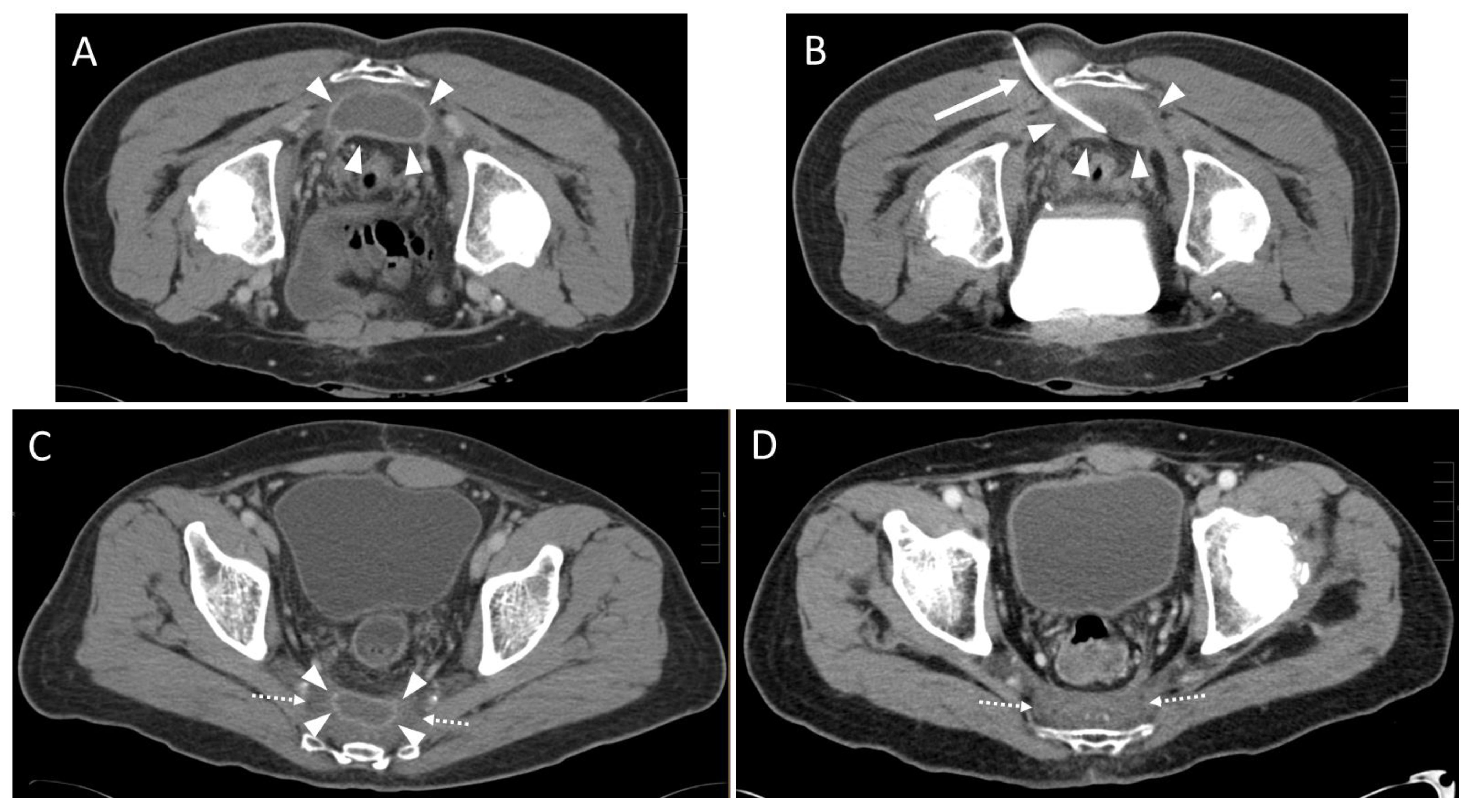 Diagnostics 13 00711 g003