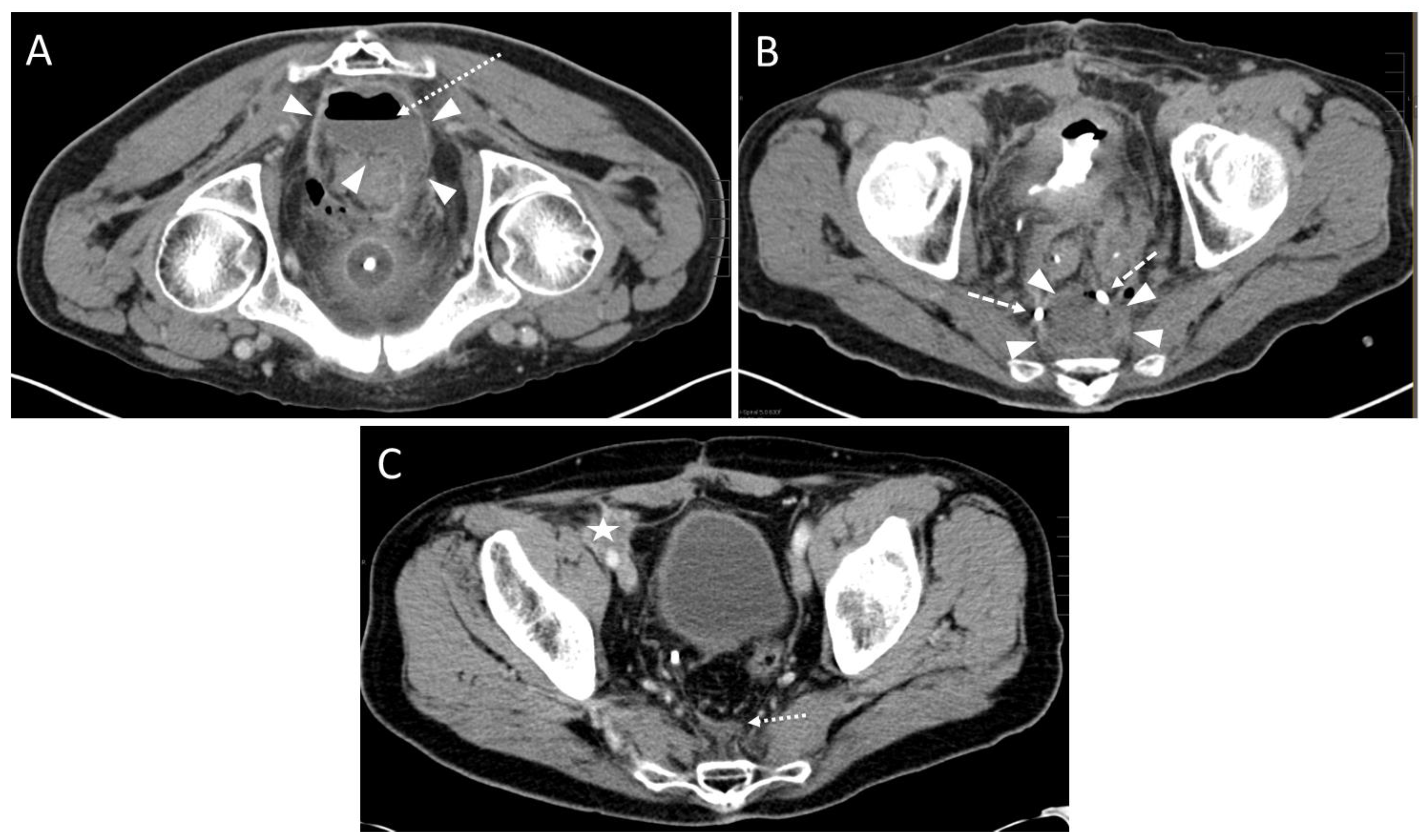 Diagnostics 13 00711 g004