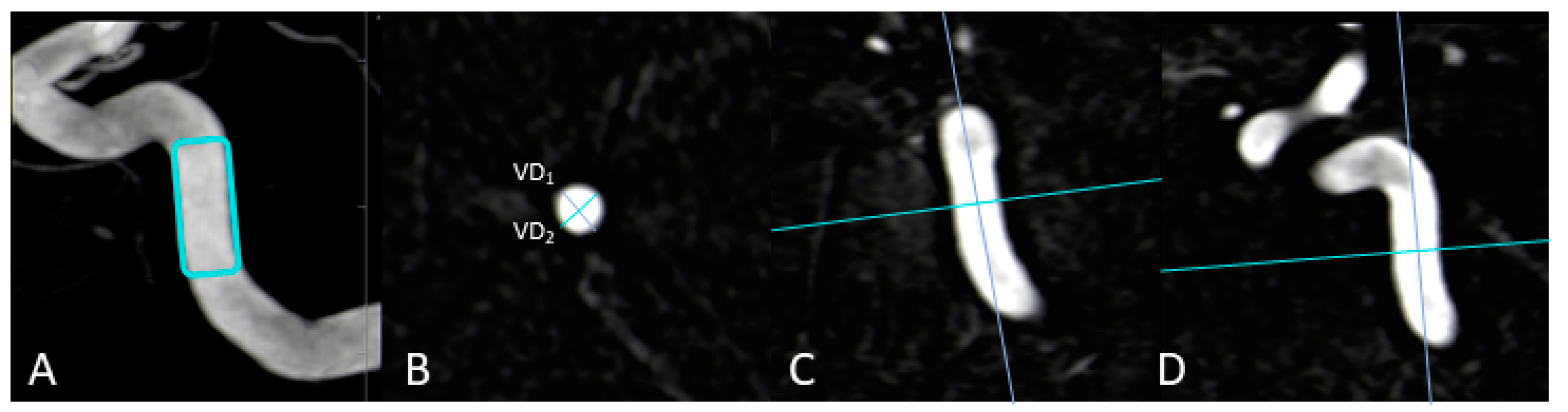 Diagnostics 13 00712 g001 Diagnostics 13 00712 g001