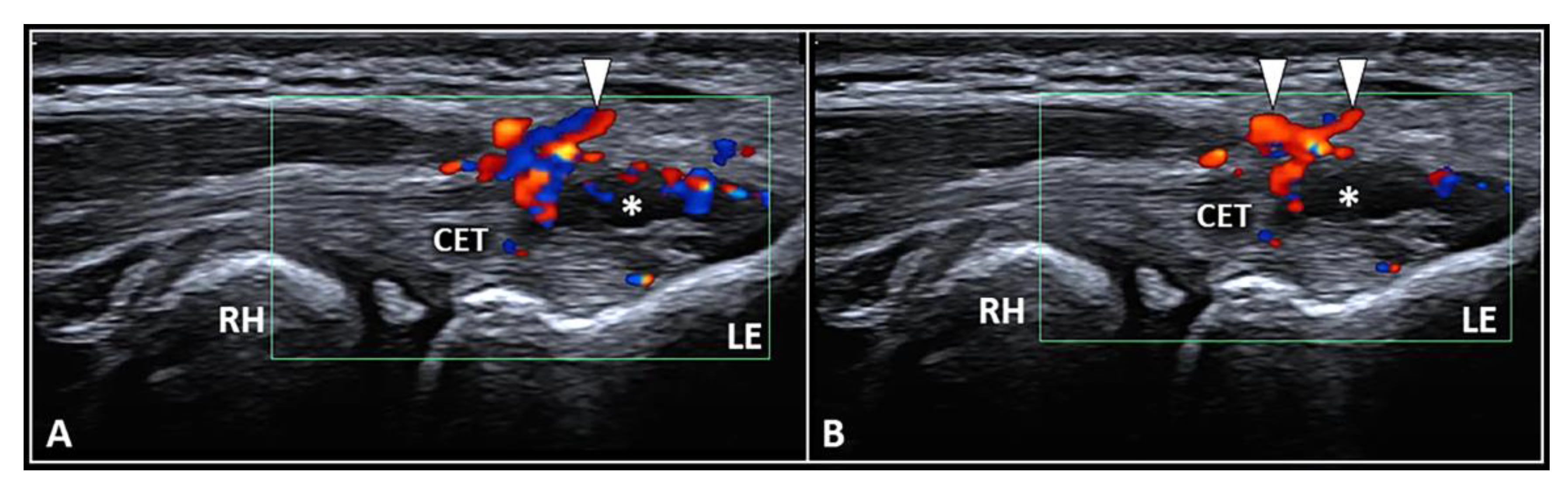 Diagnostics 13 00717 g001