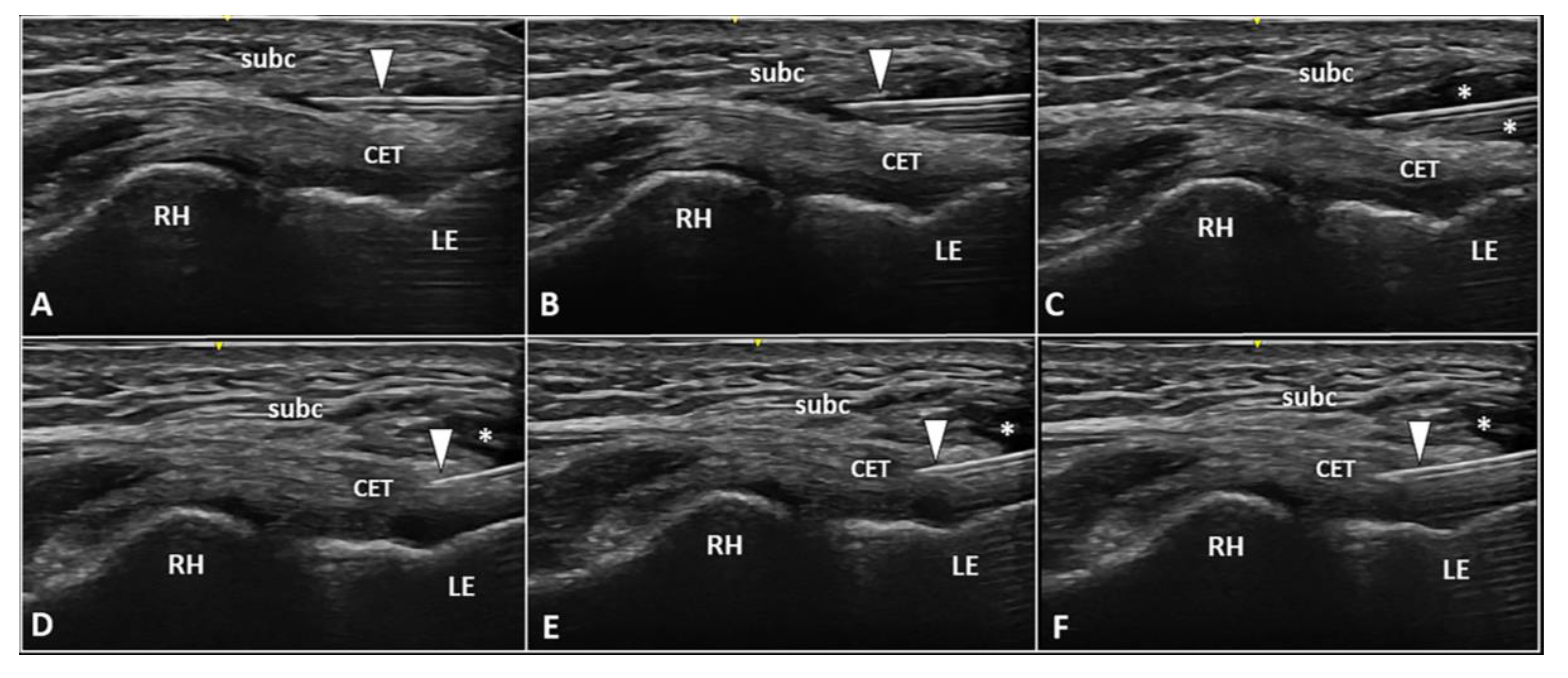 Diagnostics 13 00717 g005