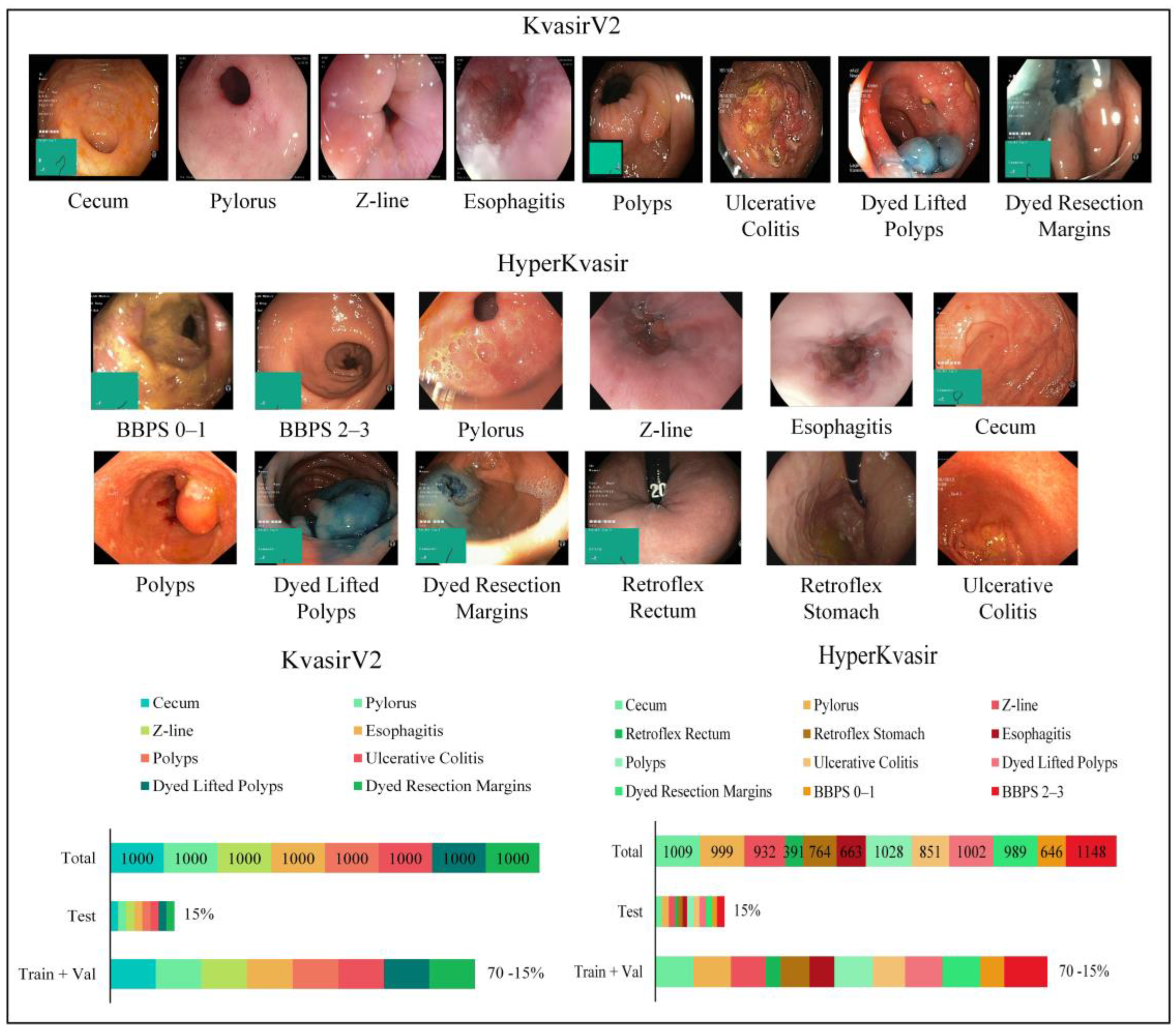 Diagnostics 13 00720 g003