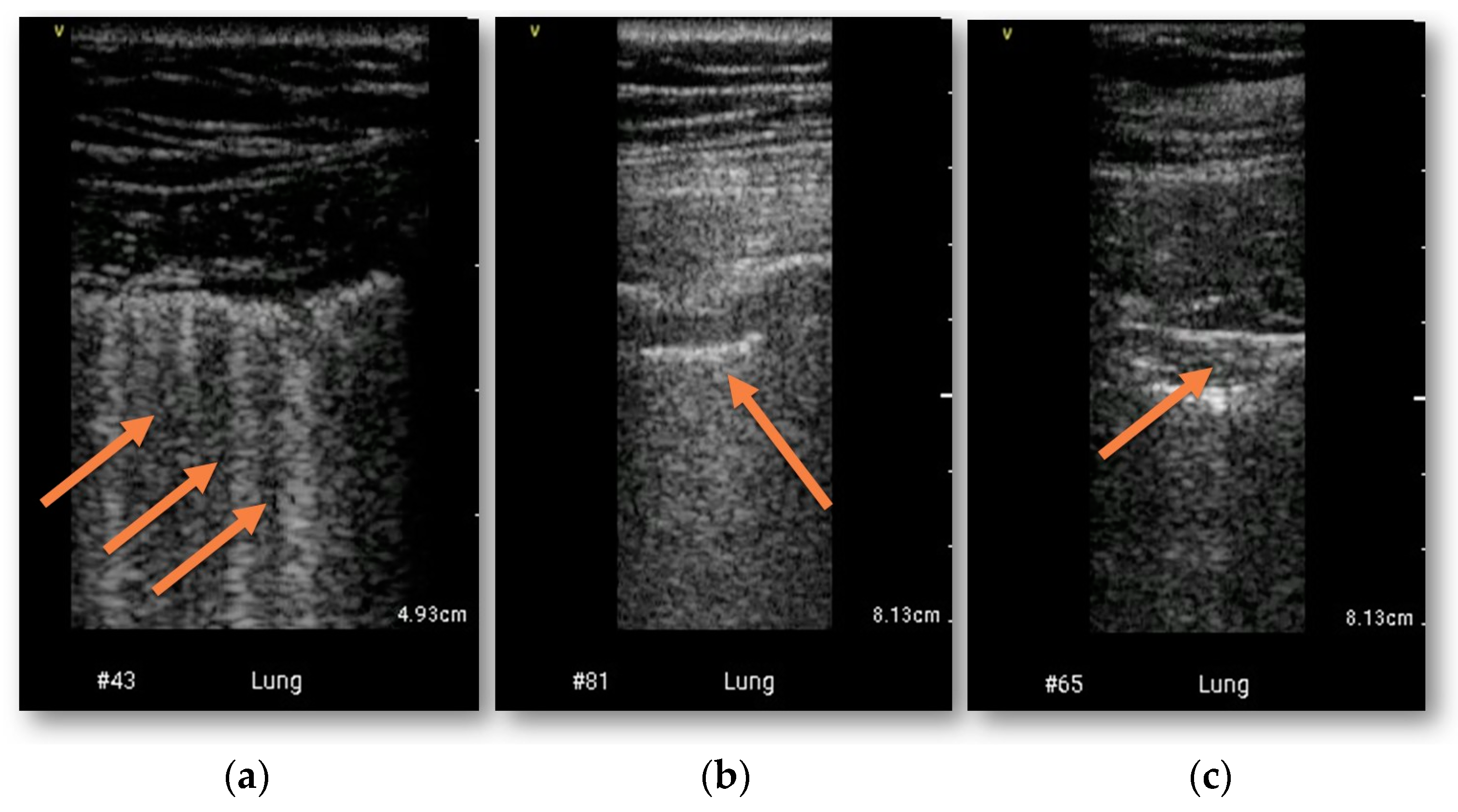 Diagnostics 13 00724 g001