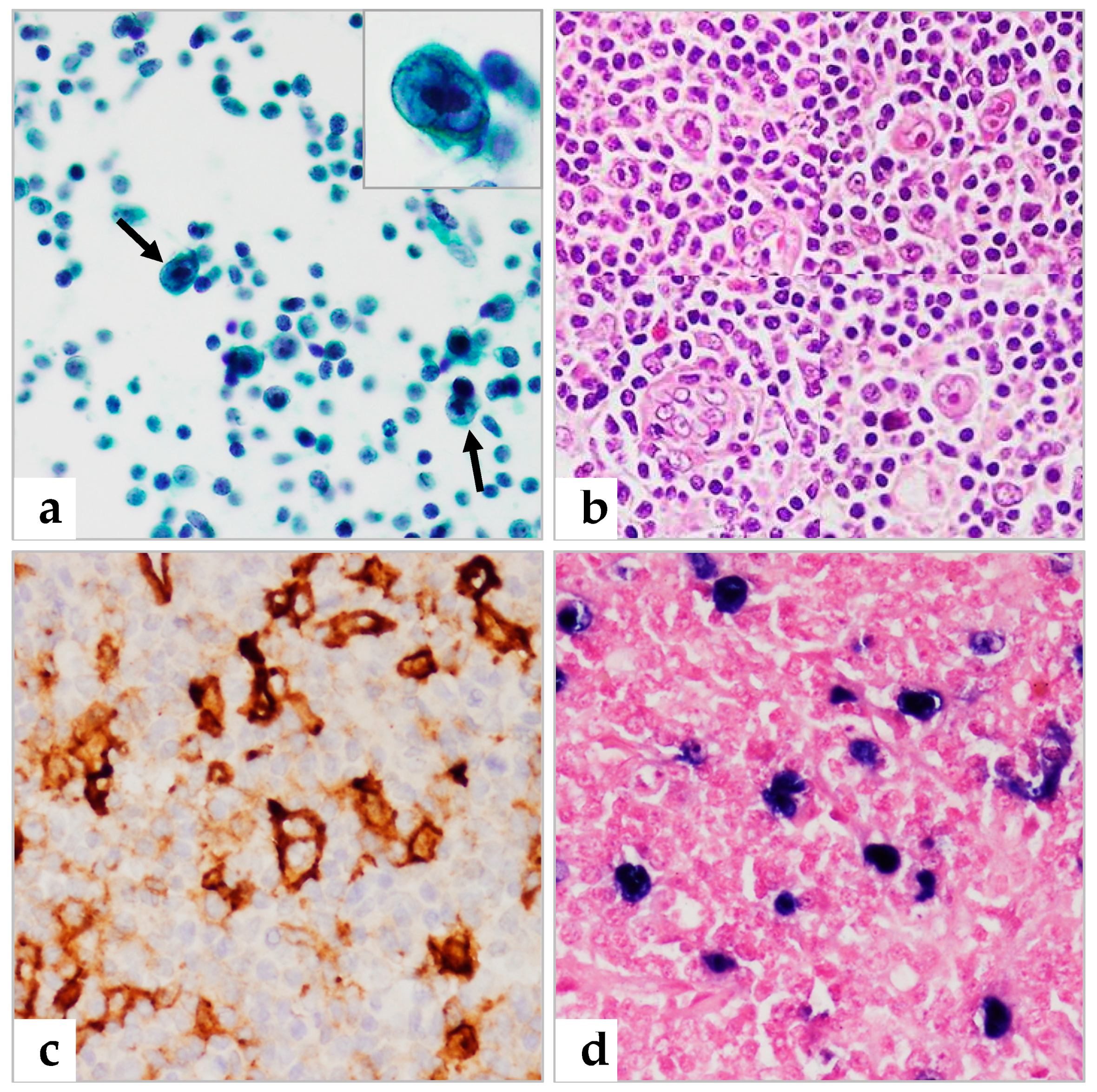 Diagnostics 13 00728 g004