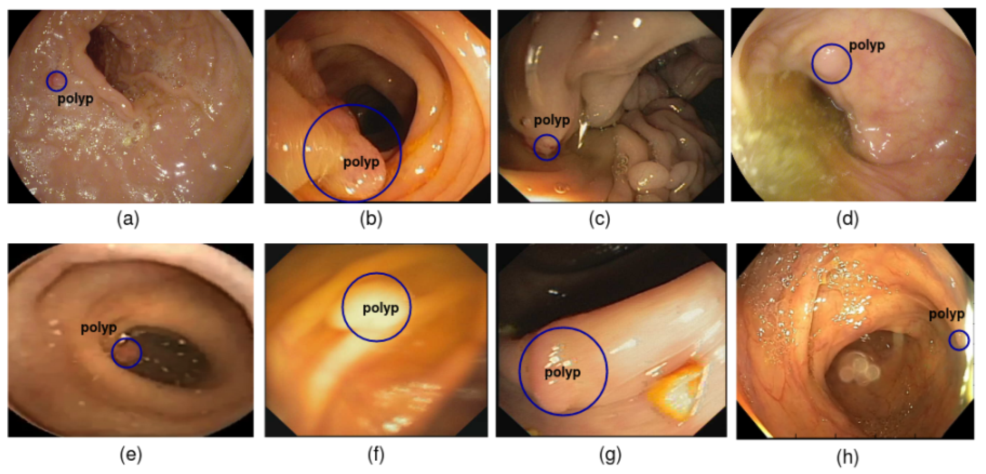 Diagnostics 13 00733 g001