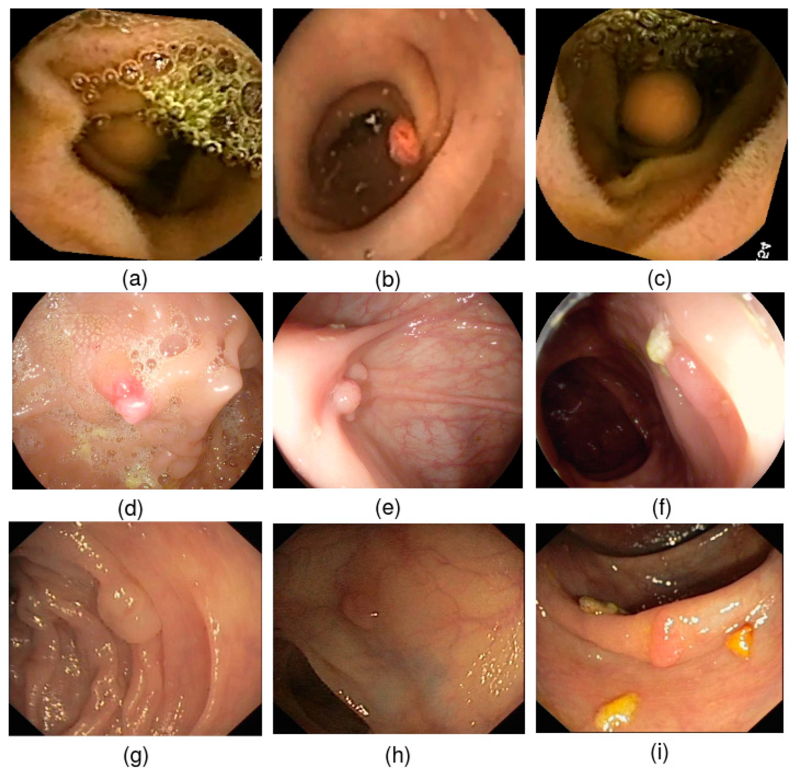 Diagnostics 13 00733 g006
