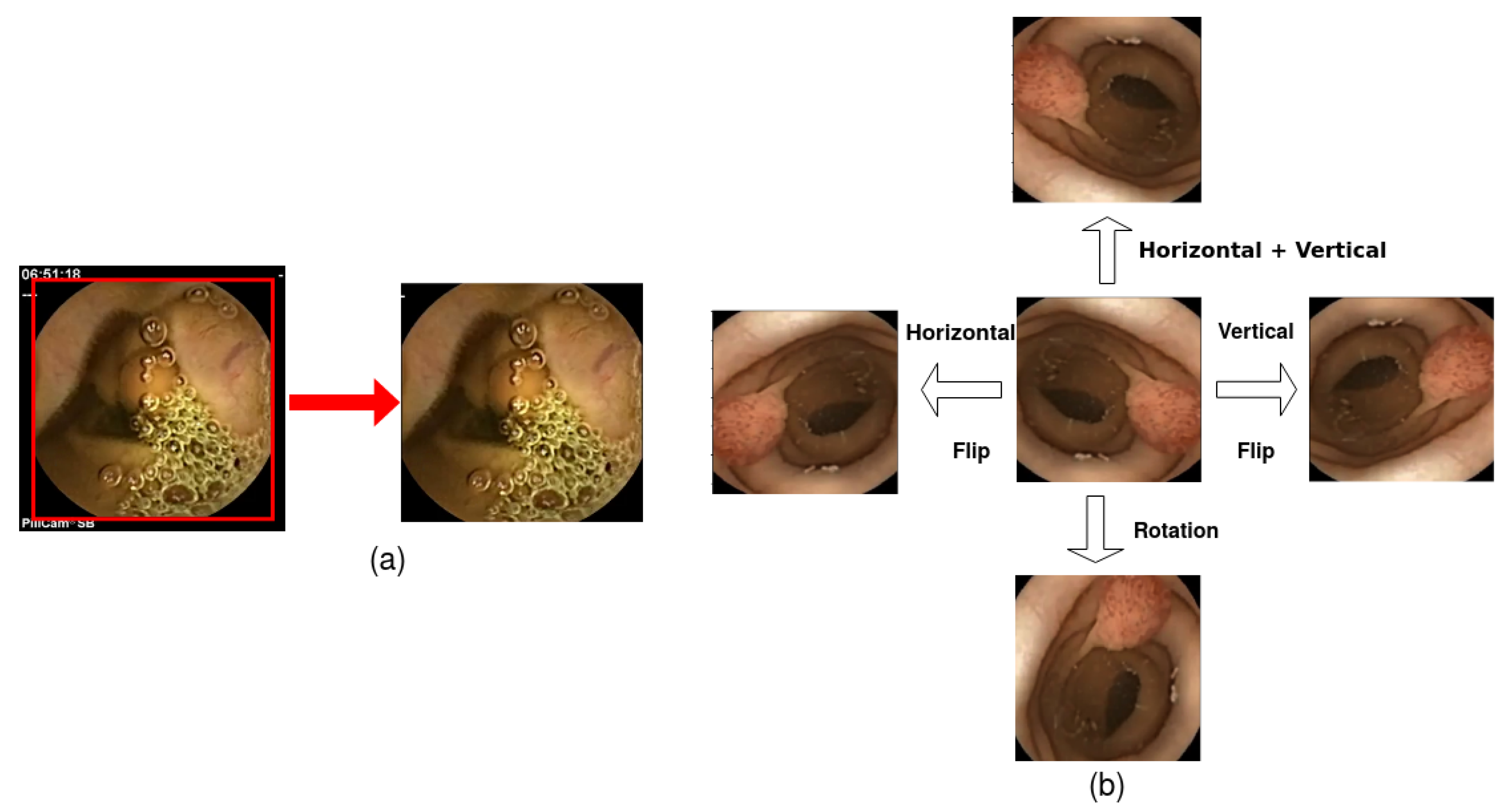 Diagnostics 13 00733 g007