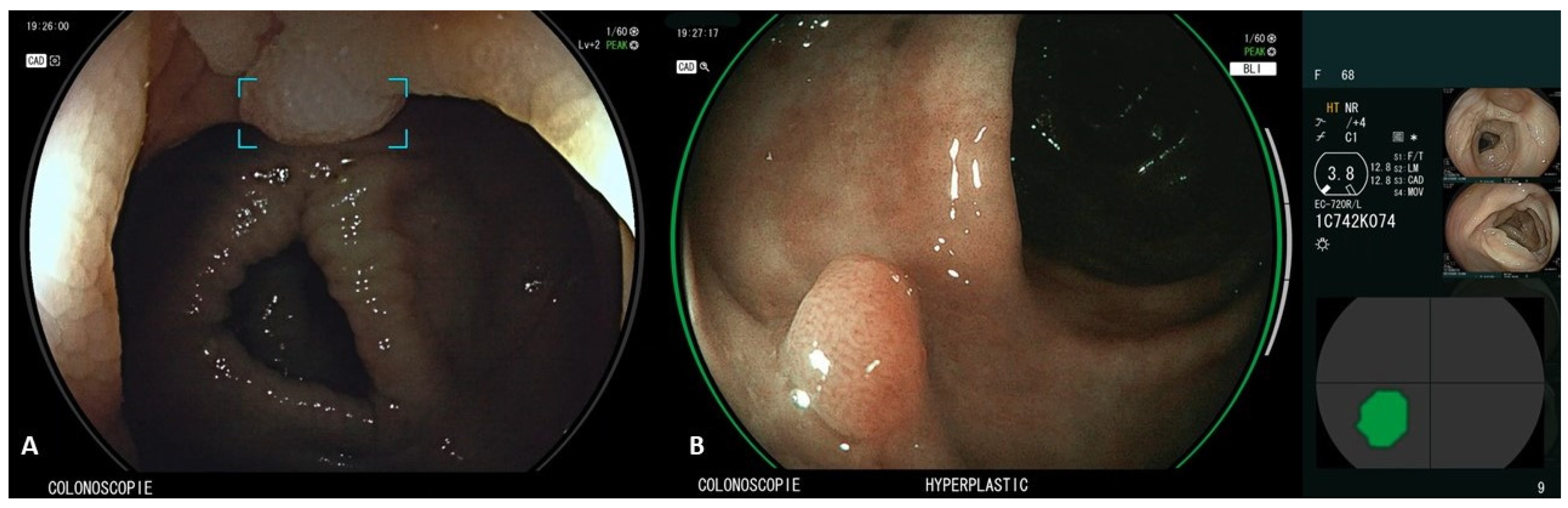 Diagnostics 13 00735 g002