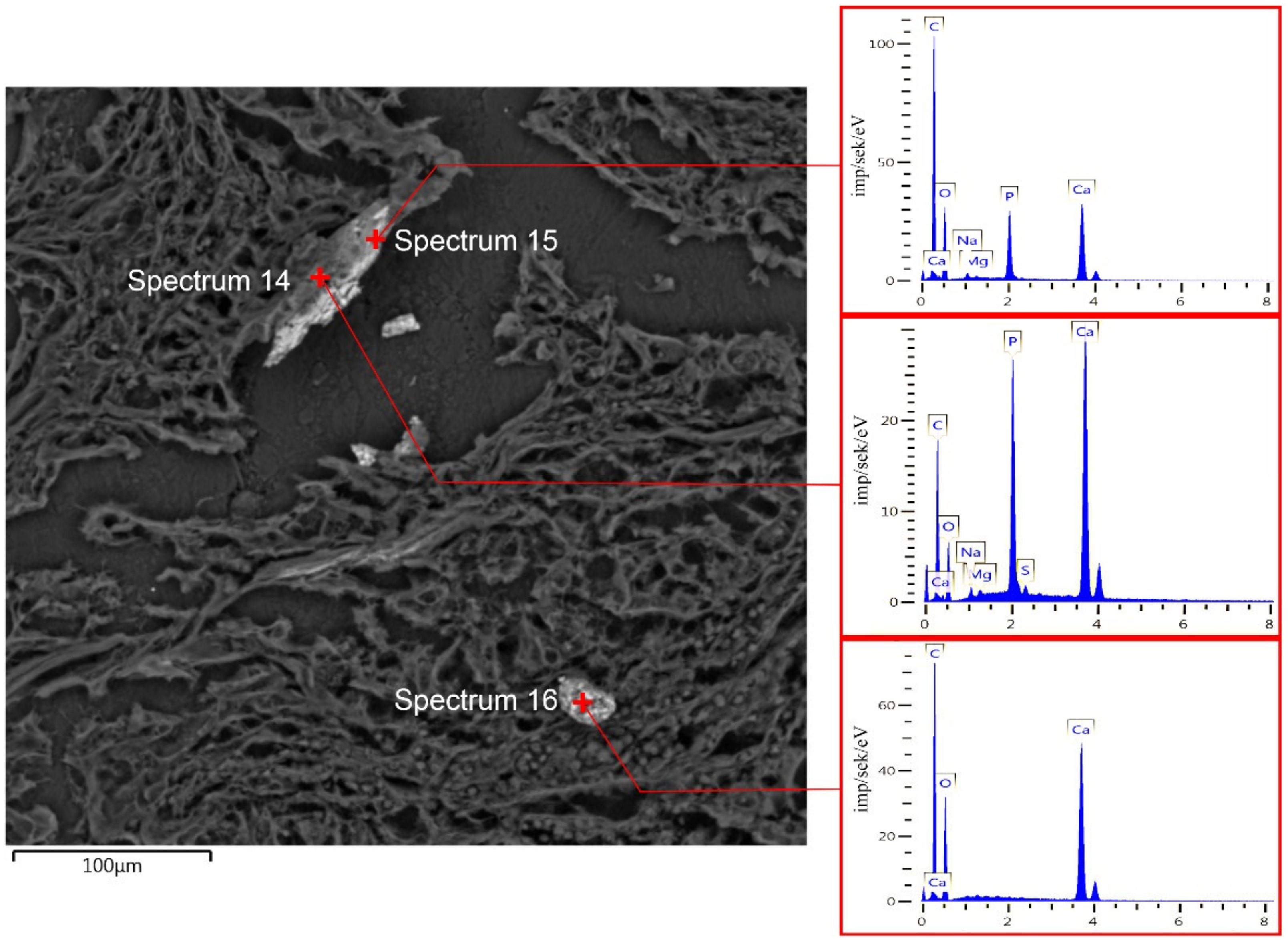 Diagnostics 13 00737 g006