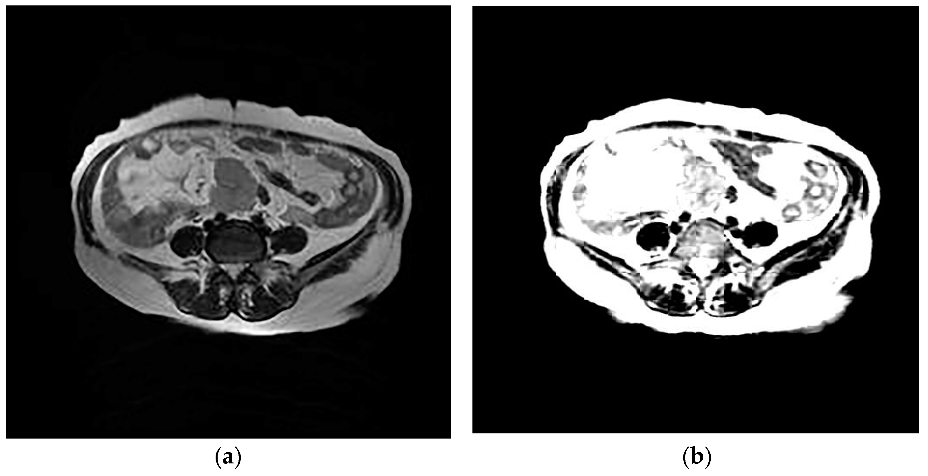 Diagnostics 13 00748 g003