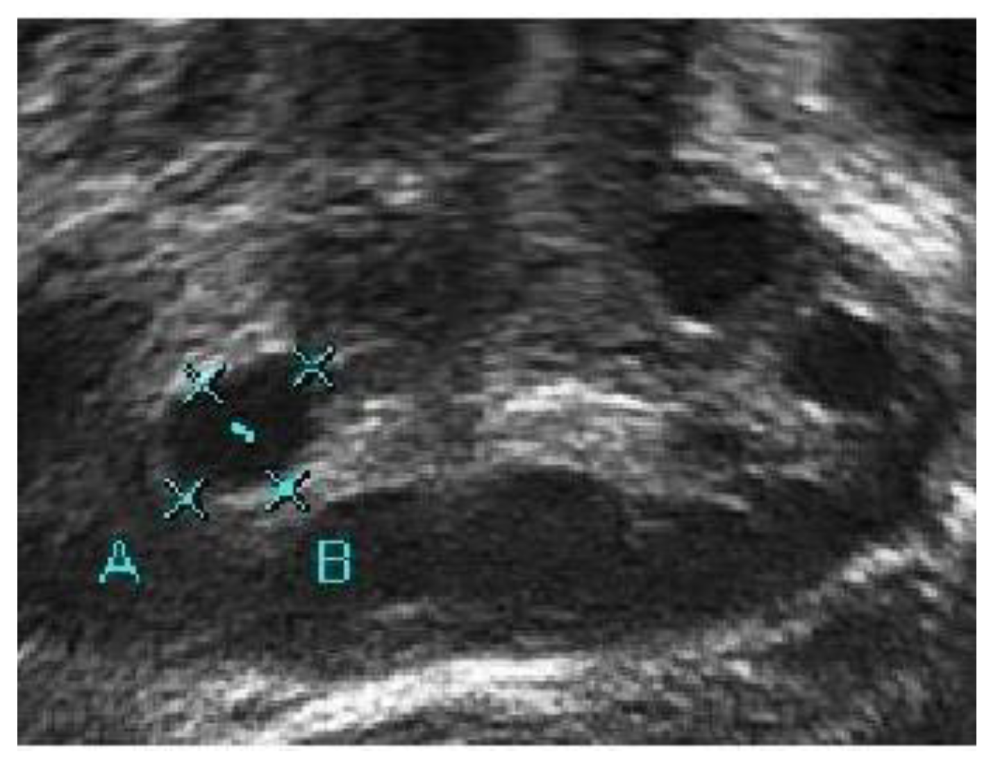 Diagnostics 13 00750 g004