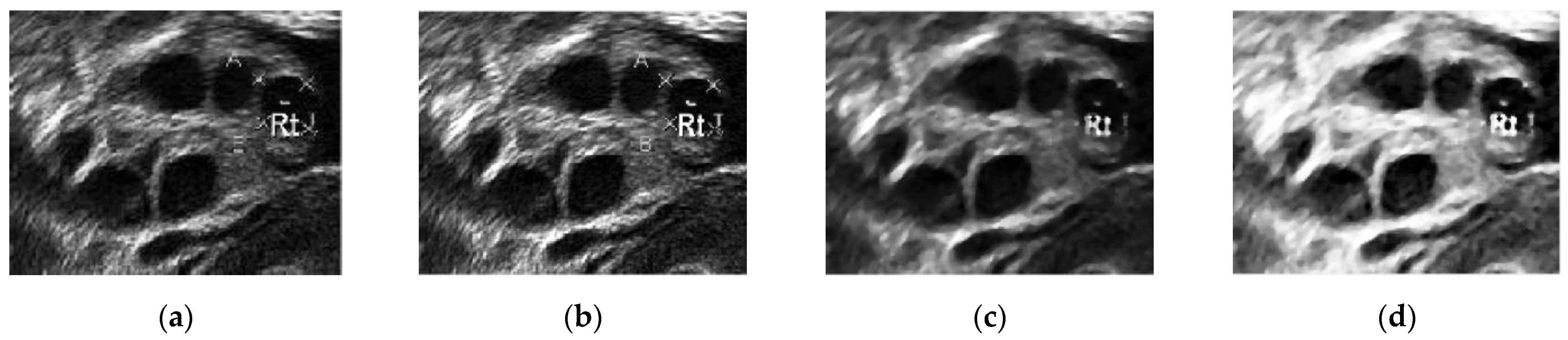 Diagnostics 13 00750 g010