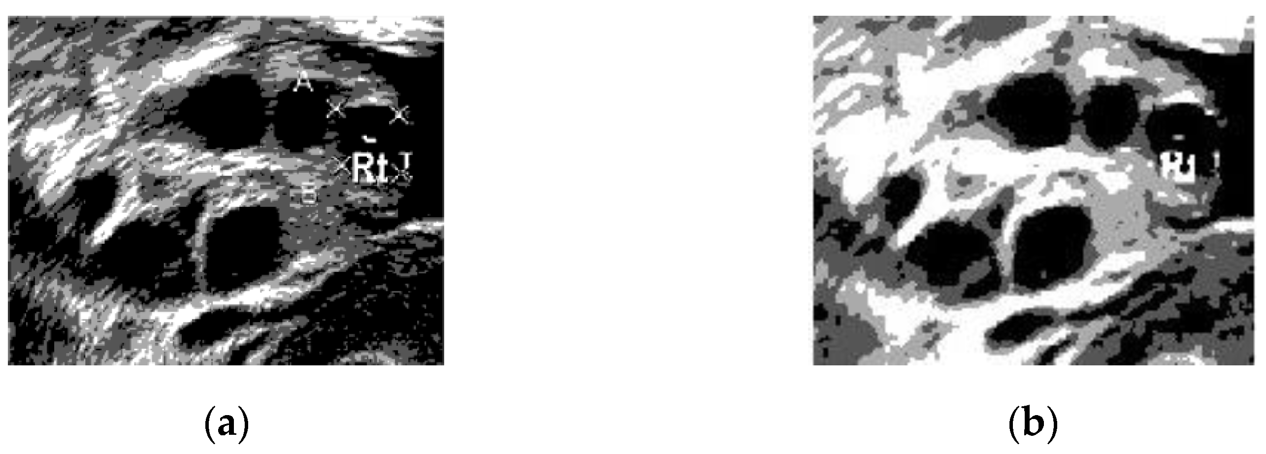 Diagnostics 13 00750 g011