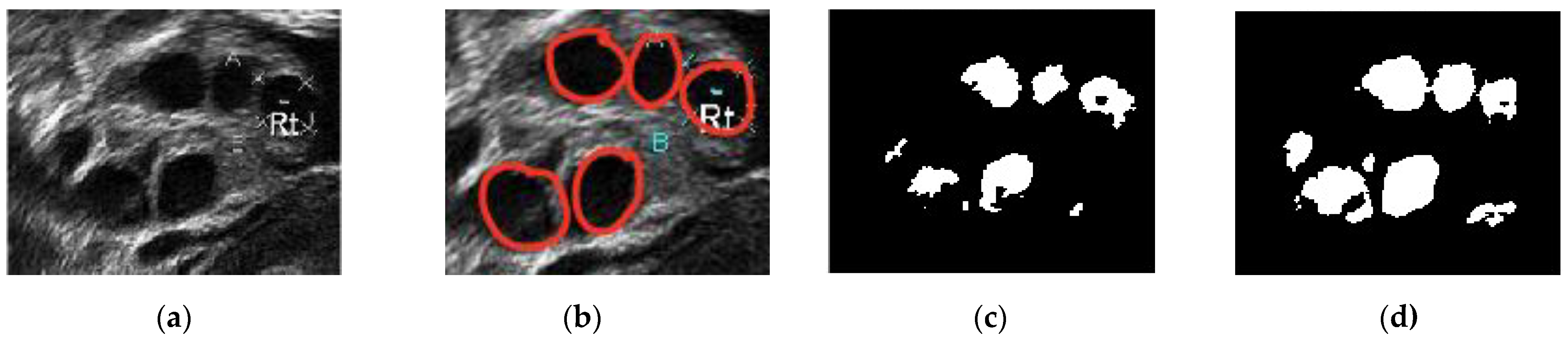 Diagnostics 13 00750 g012