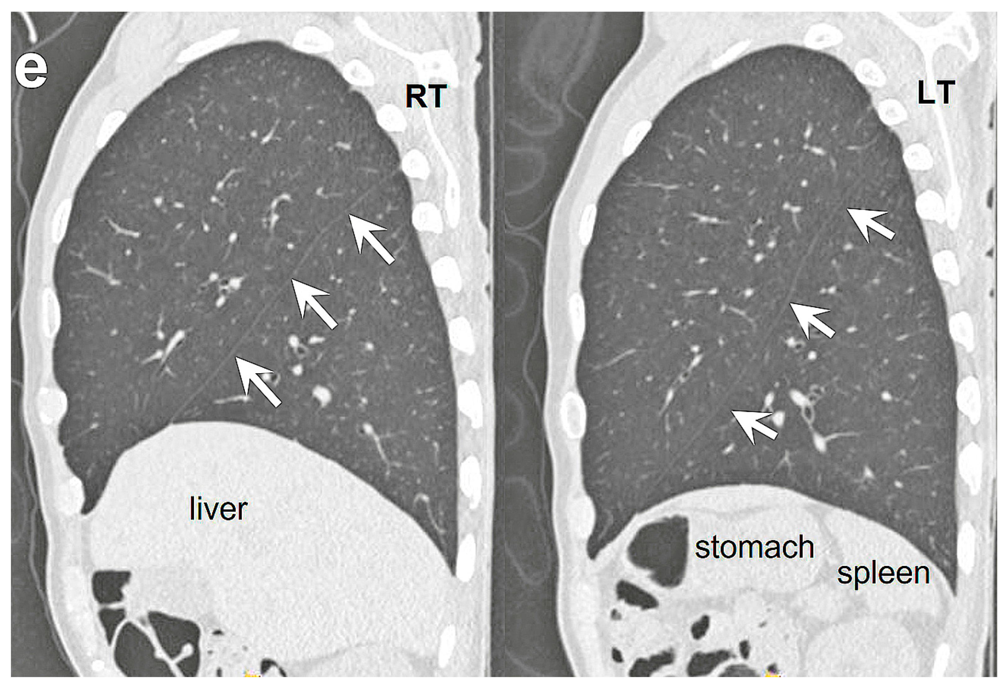 Diagnostics 13 00751 g001b