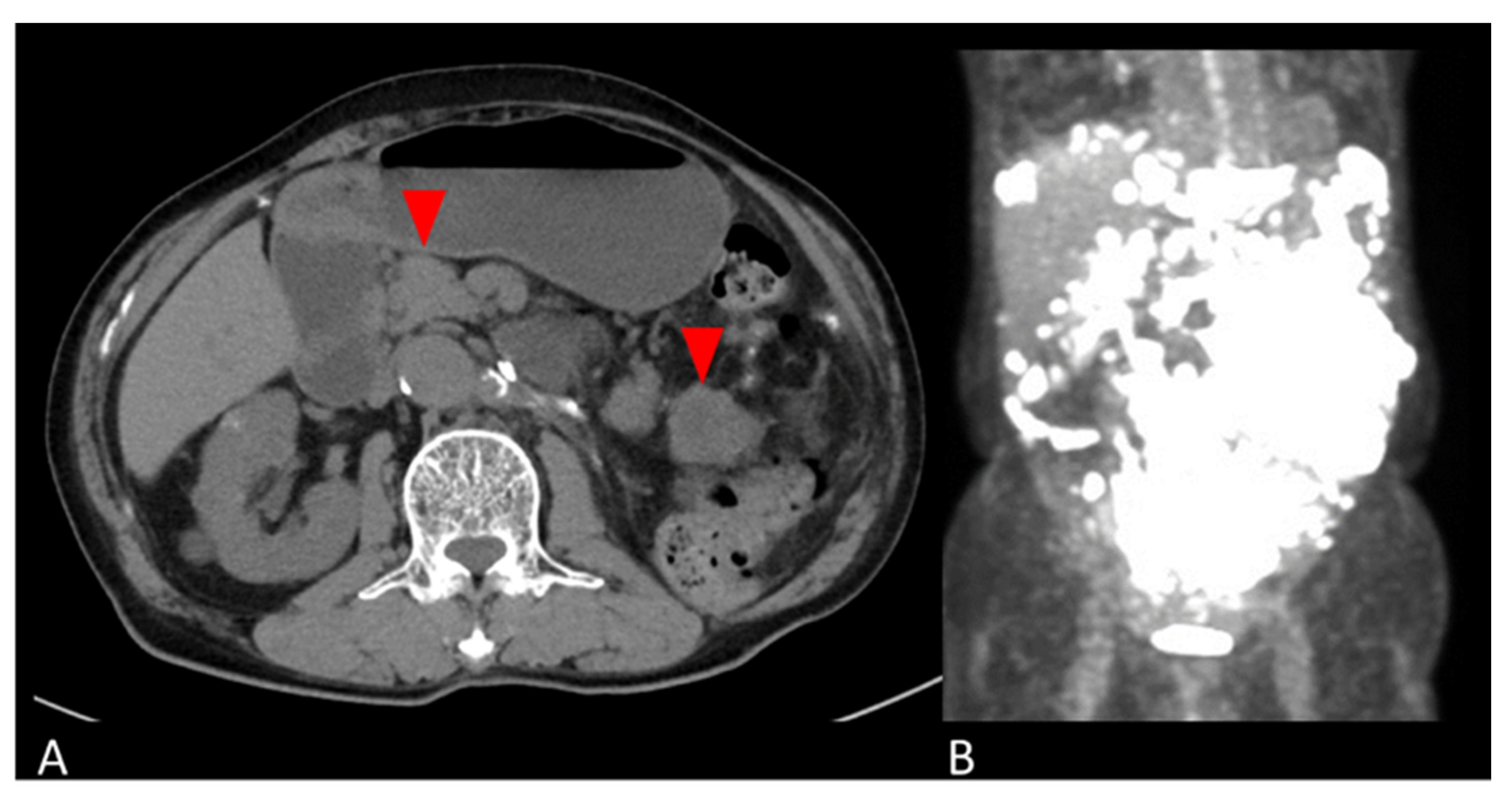 Diagnostics 13 00752 g002