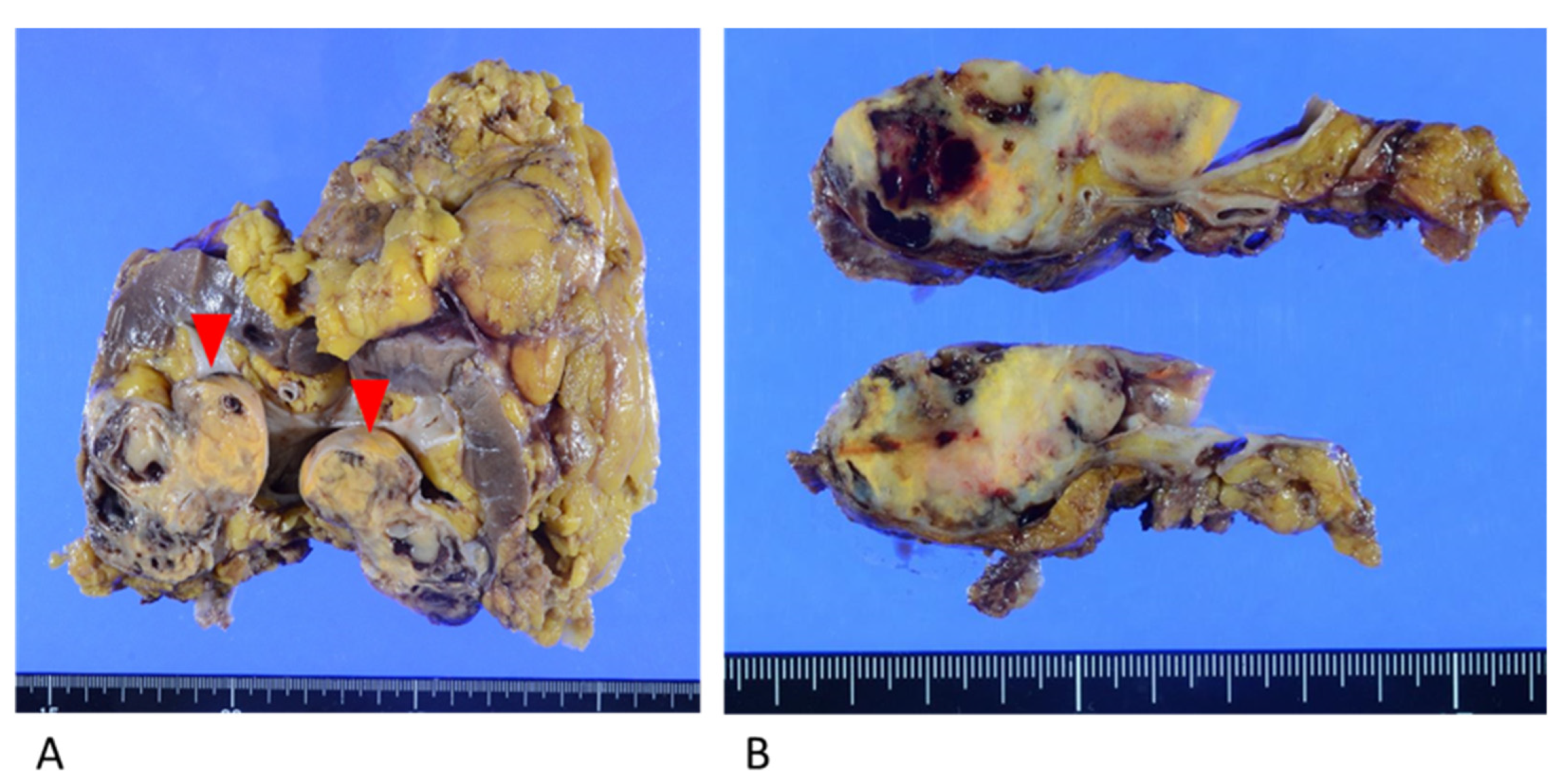 Diagnostics 13 00752 g003