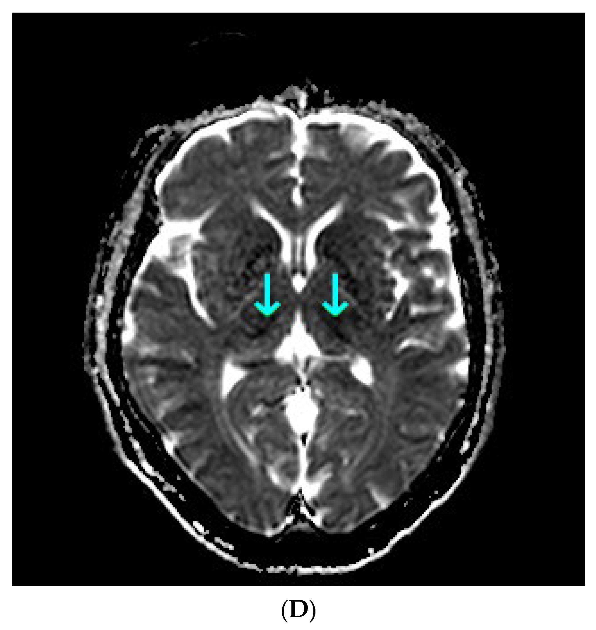 Diagnostics 13 00753 g001c